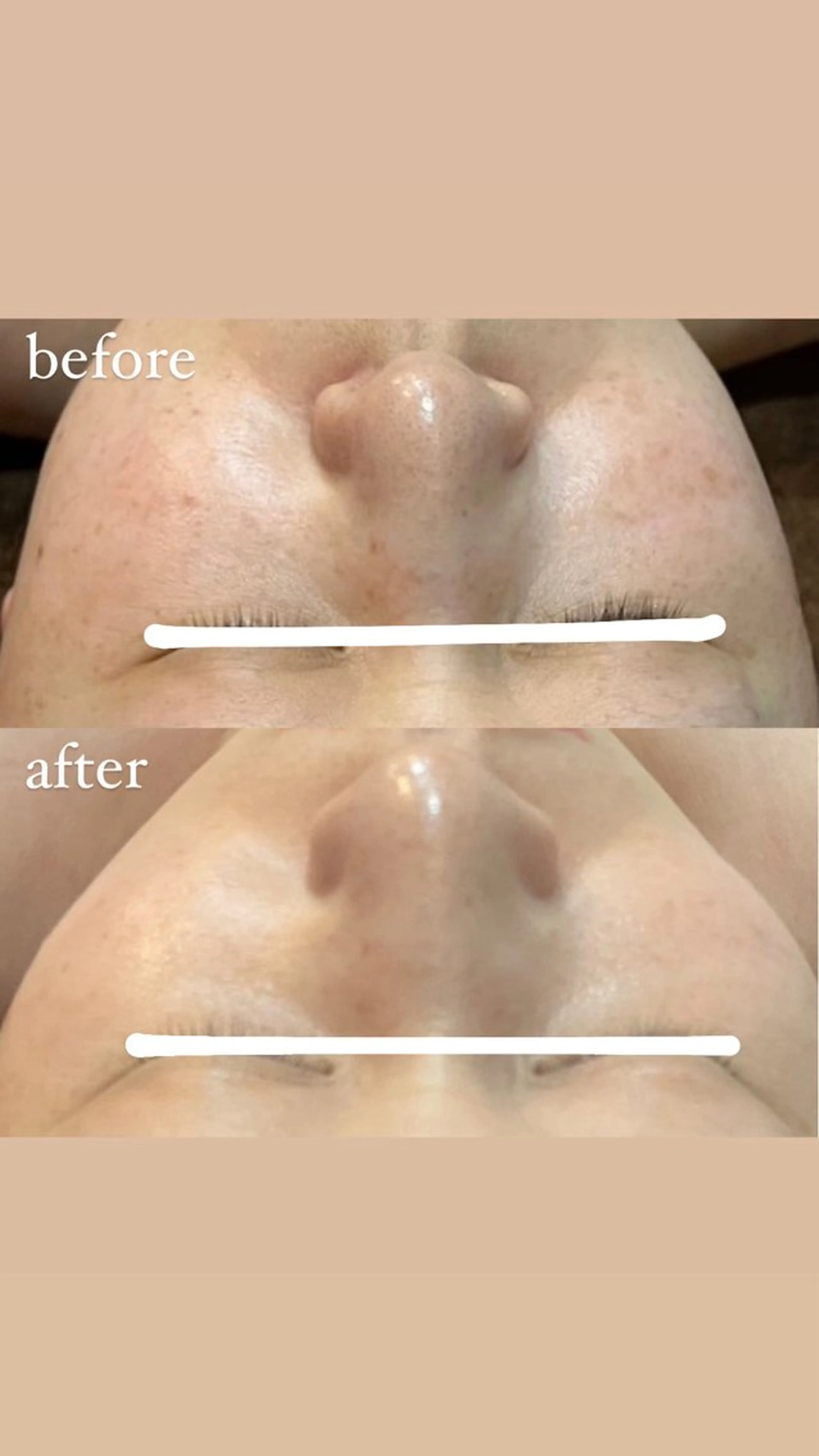 brilliance所属・老化肌トラブル肌専門 Brillianceのエステ・リラクイメージ