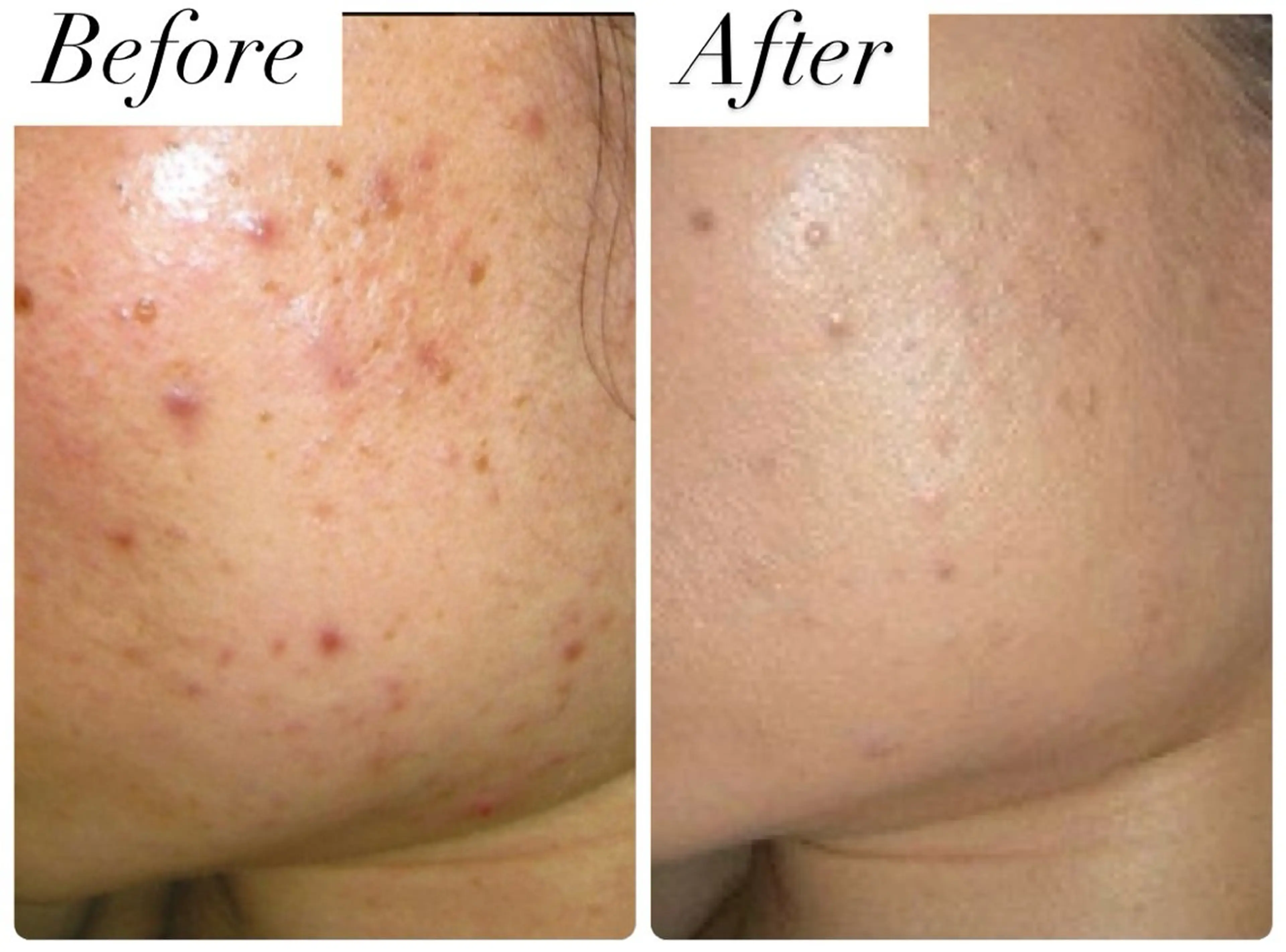 エステ 脱毛&フェイシャル 専門店muro.のエステ・リラクイメージ