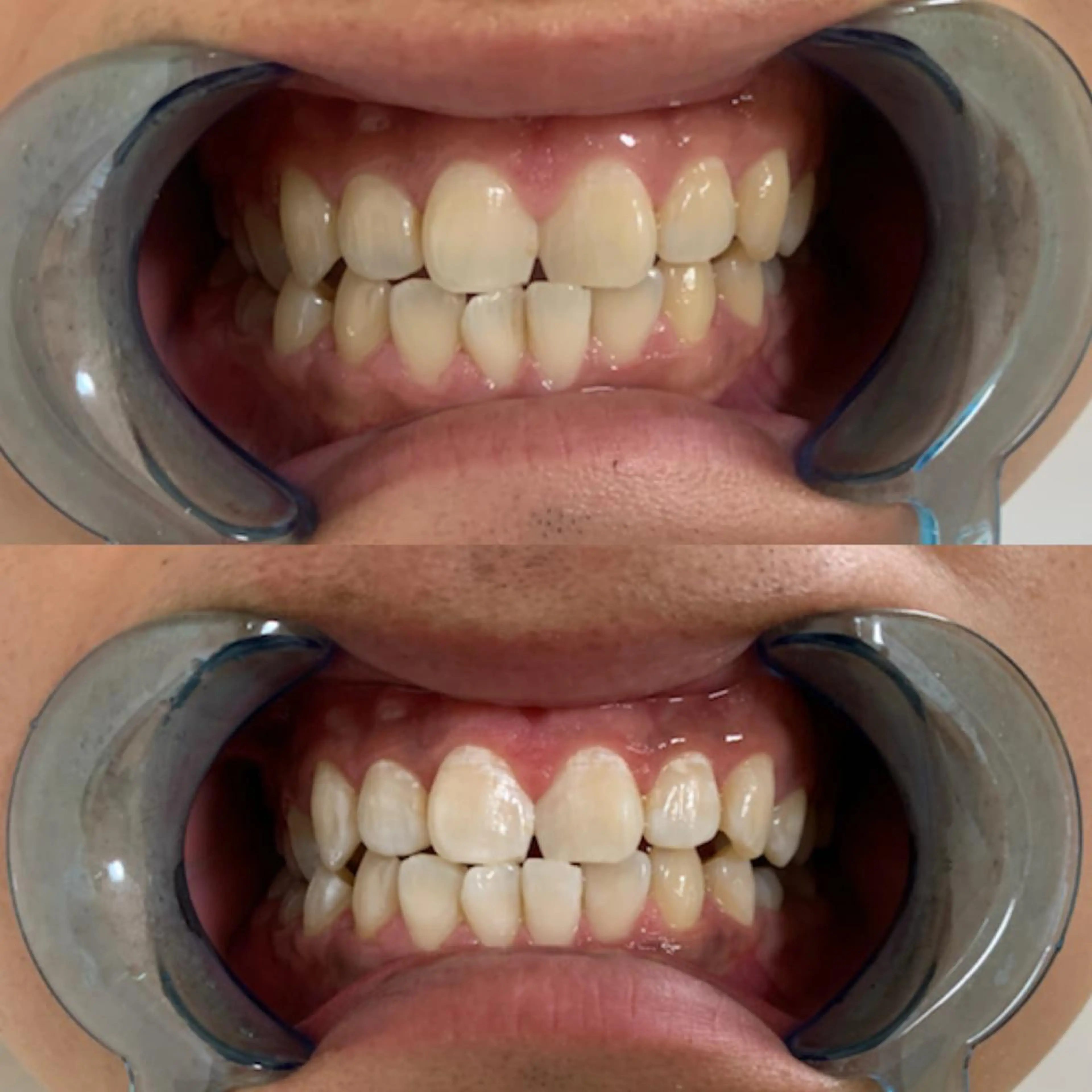 ロング その他 藤本 真心のネイルデザイン