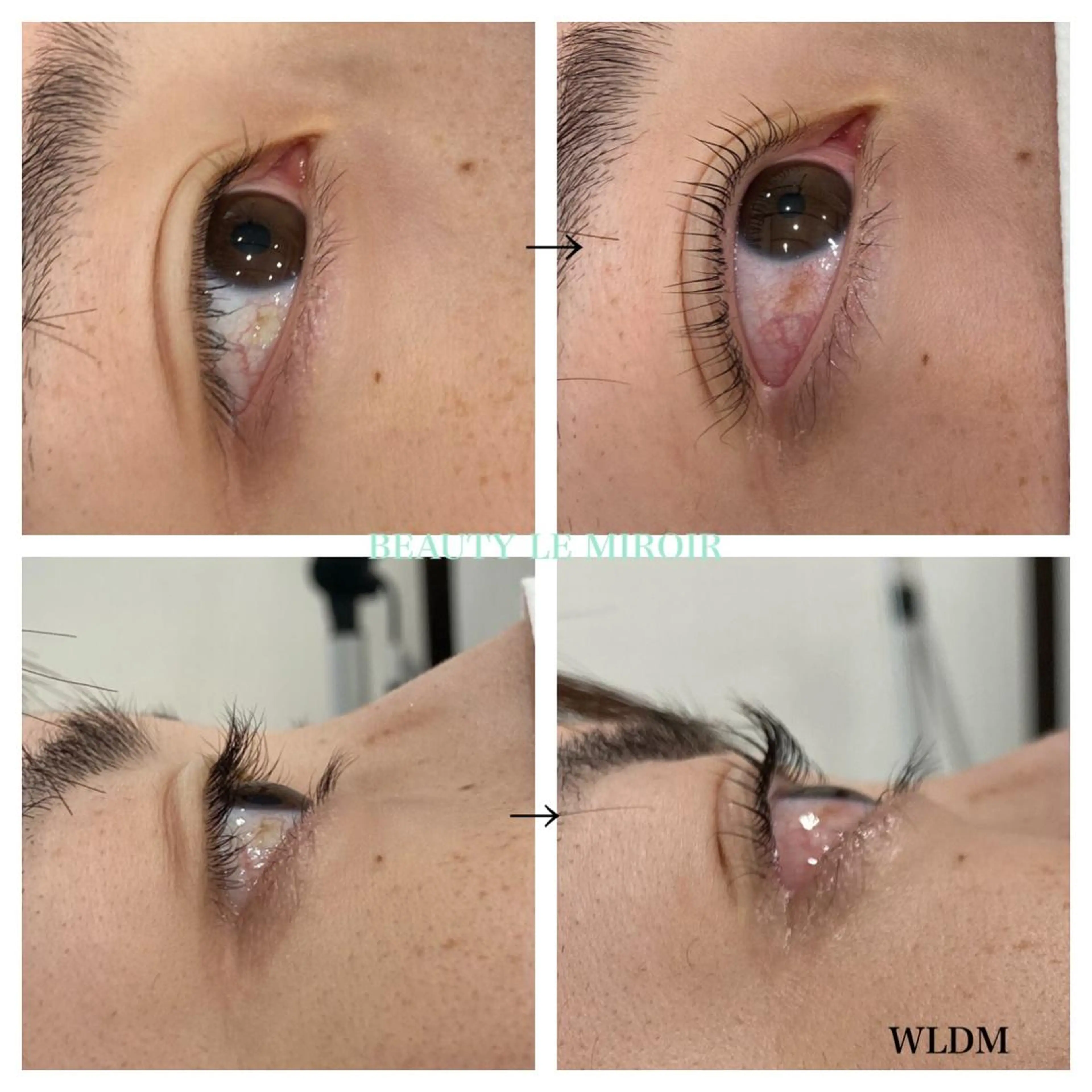 マツエク・マツパ ビューティー ミロワールのエステ・リラクイメージ