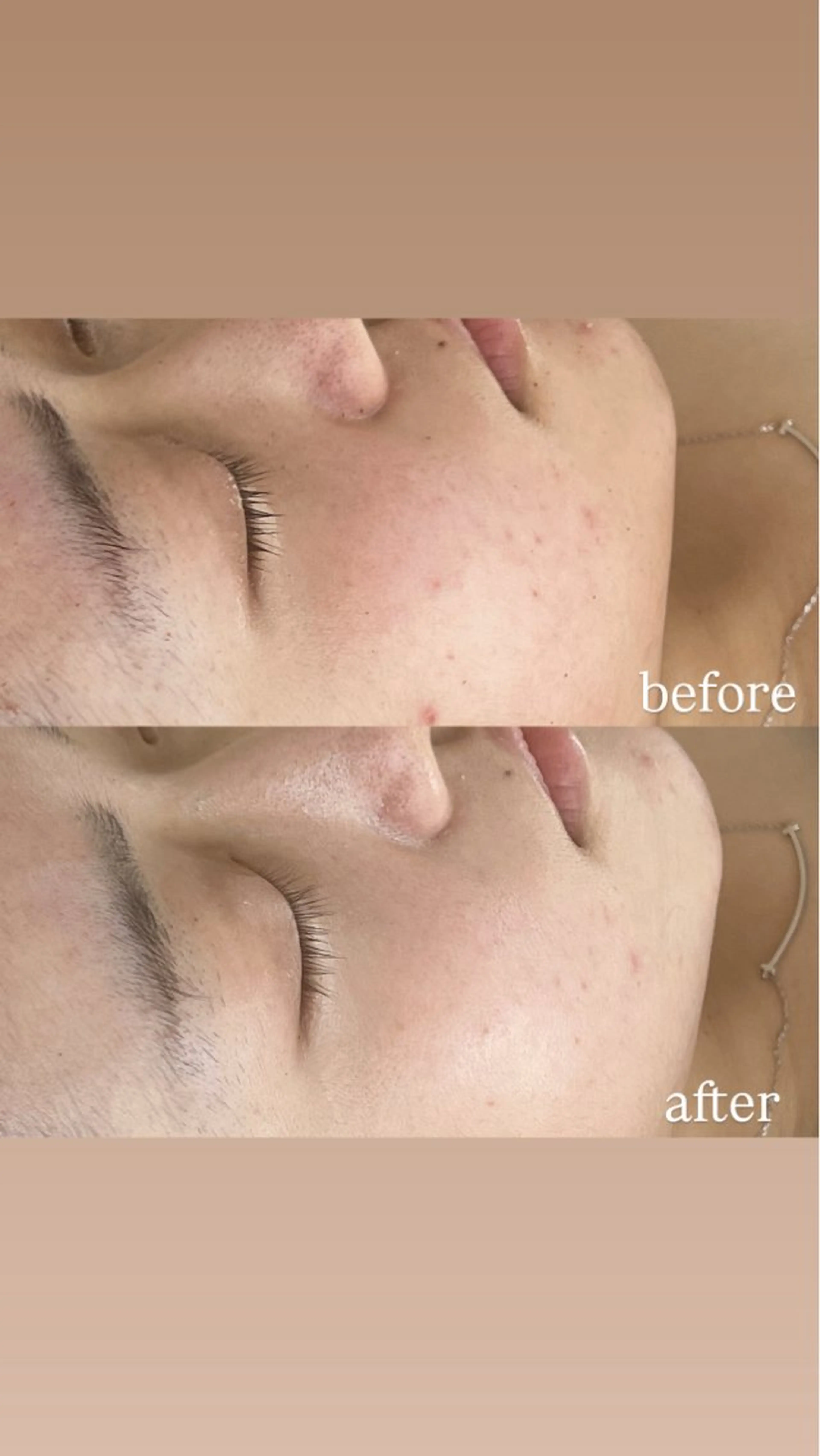 エステ ohana所属・河合 菜月のエステ・リラクイメージ