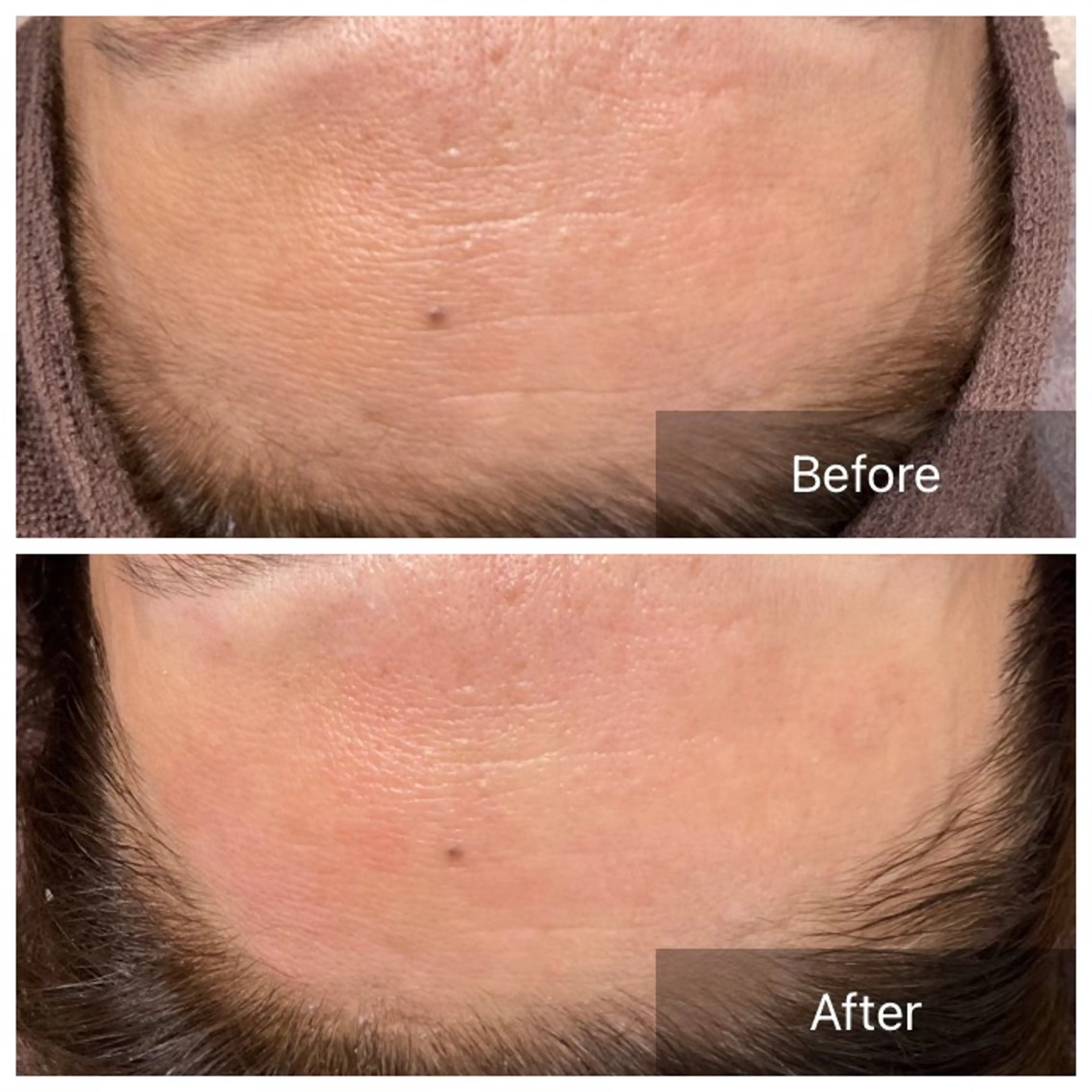 脱毛 産毛専門店 Bittoのエステ・リラクイメージ