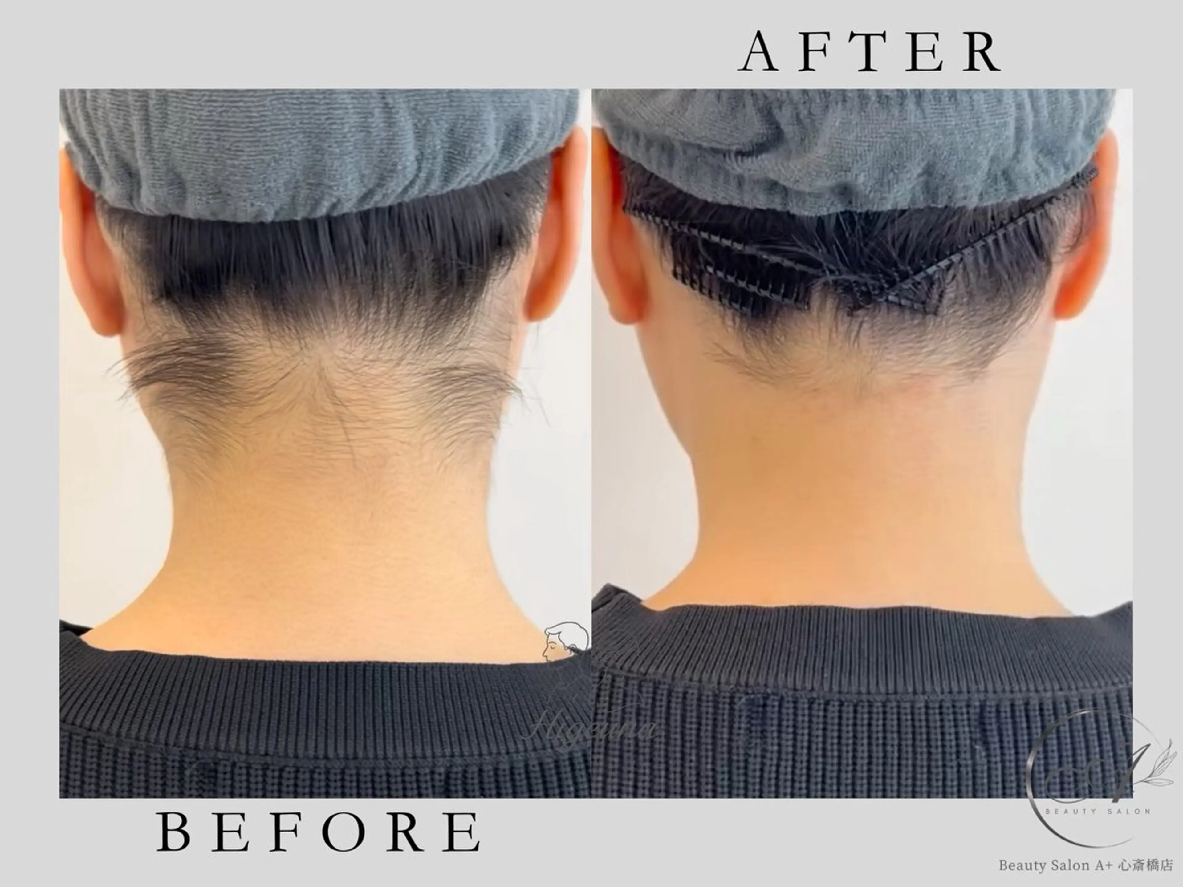 脱毛 BeautysalonA所属・うなじ脱毛/ つや肌ハーブのエステ・リラクイメージ