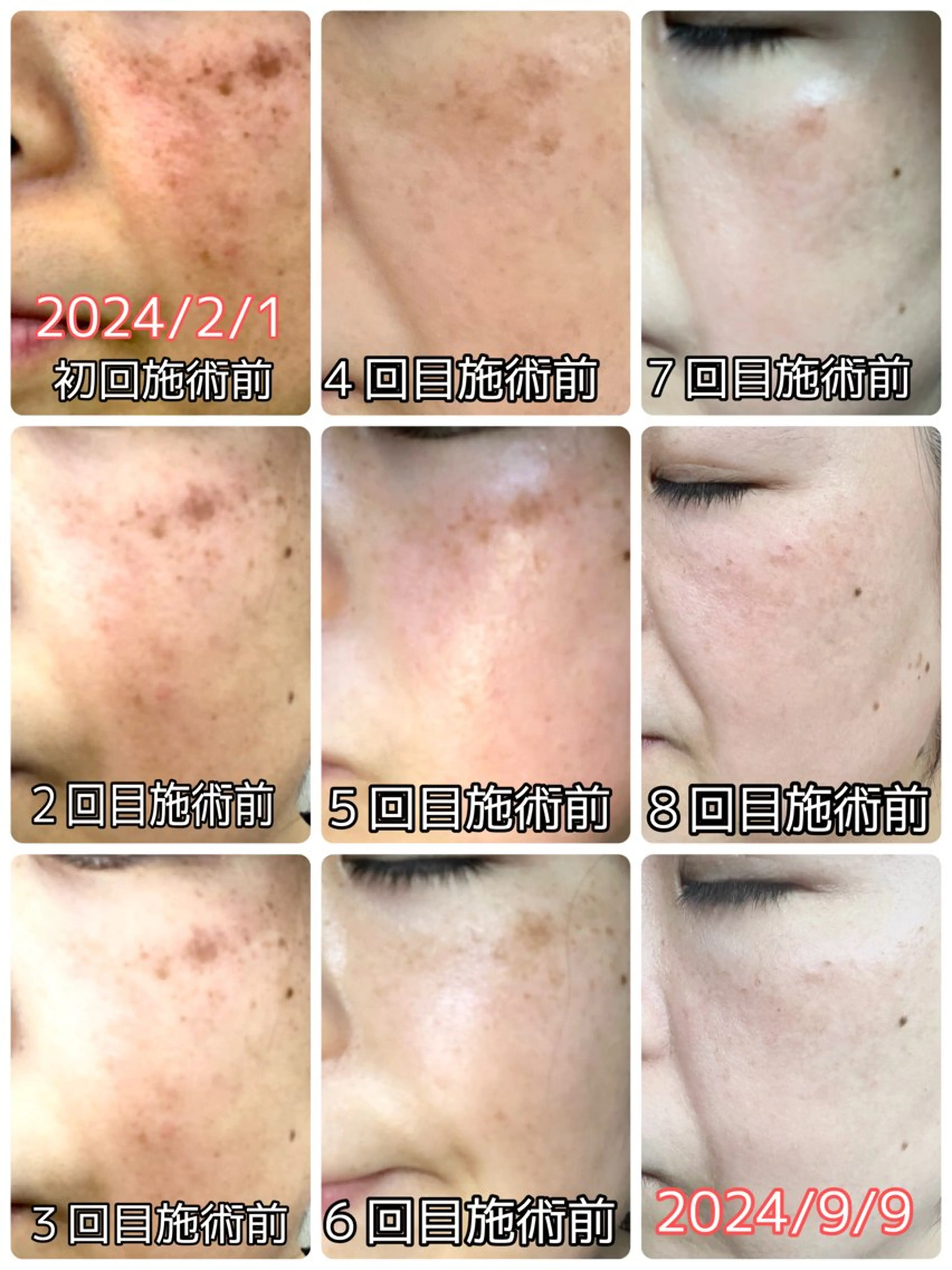 スリーエスプラス内　美肌サロンEme所属・希映 -kieのエステ・リラクイメージ