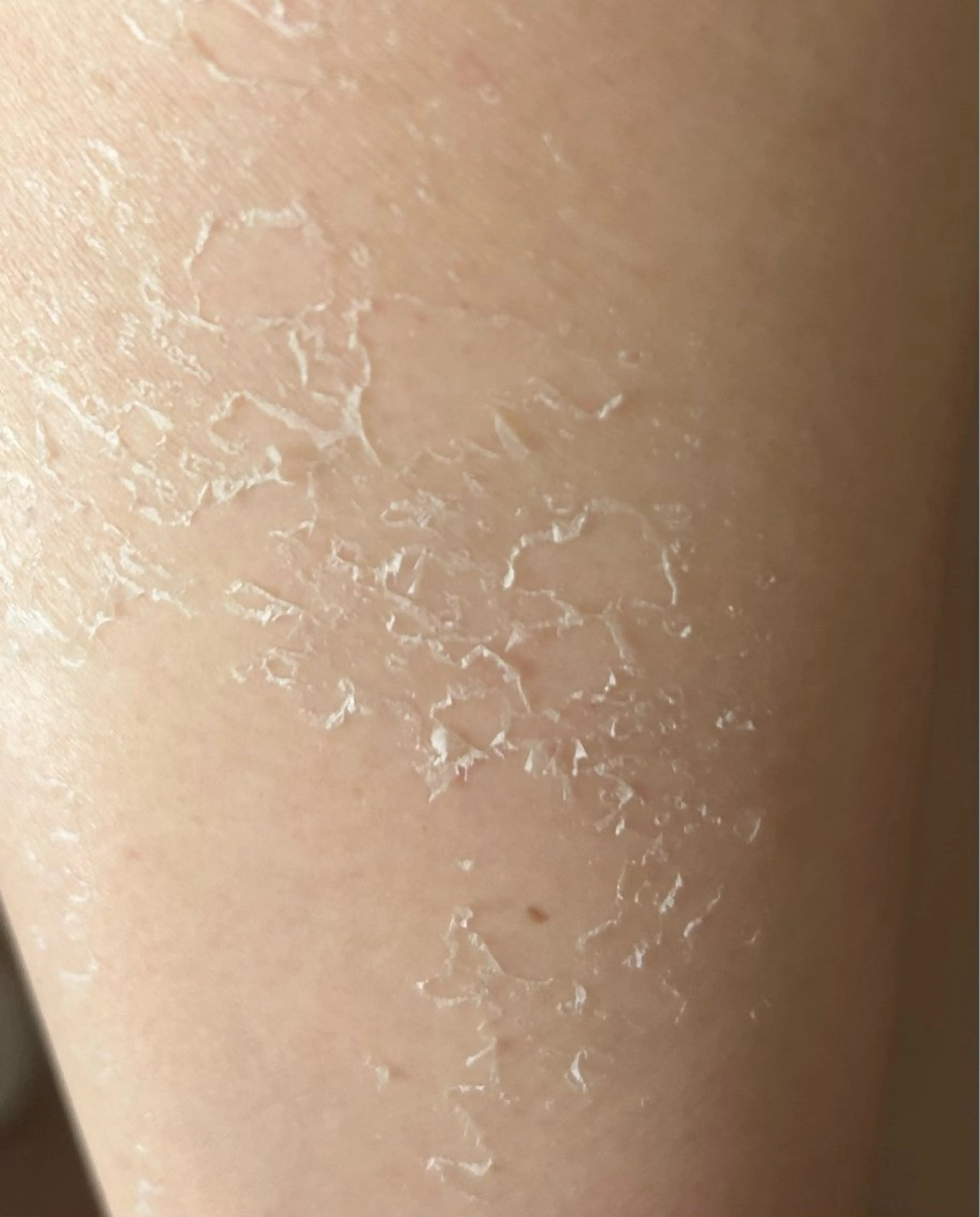 エステ clé skin 🌿ハーブピーリングのエステ・リラクイメージ