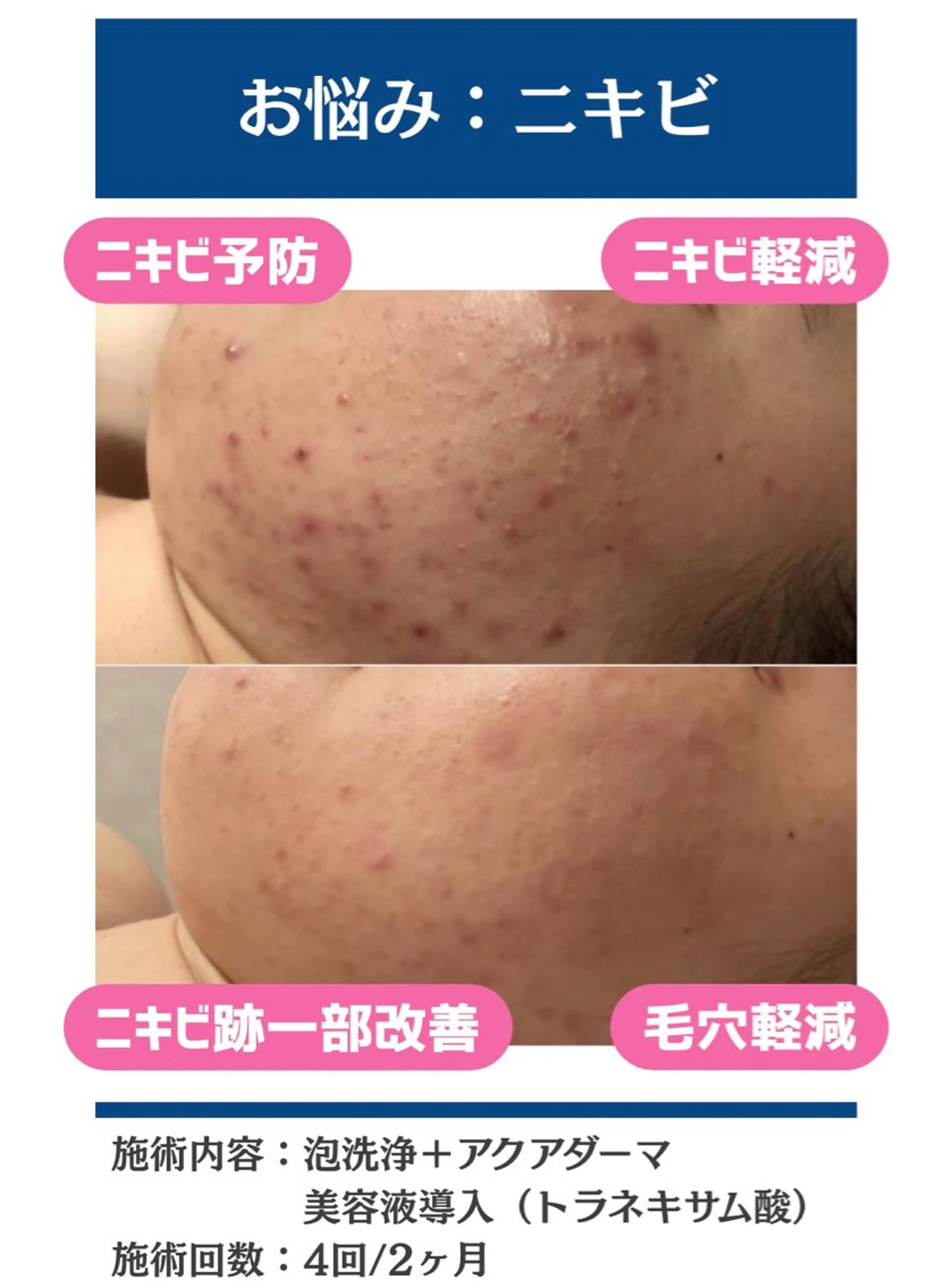 毛穴レス美肌へ🌿 看護師Abe🌼のエステ・リラクイメージ