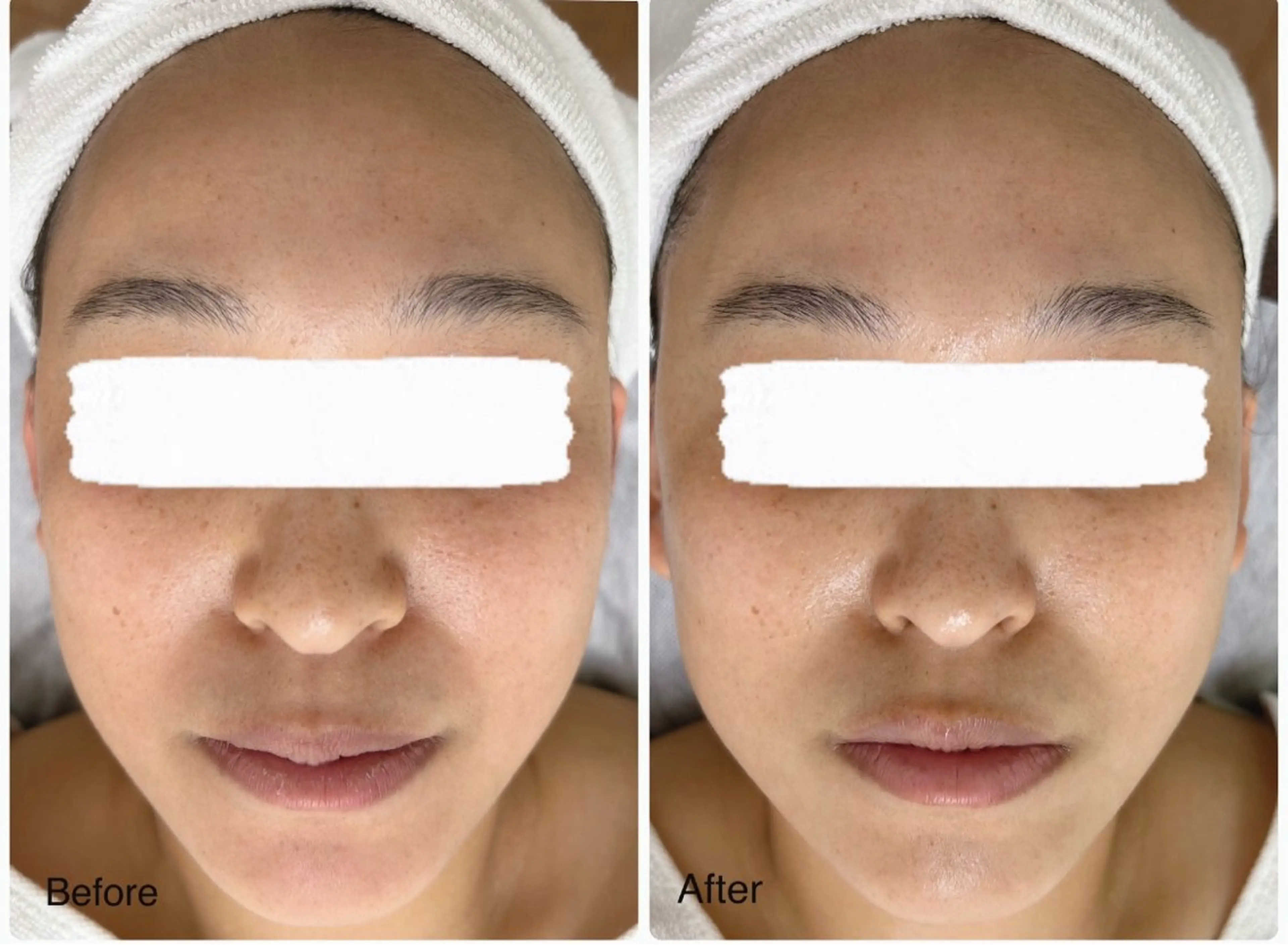 ♡美肌エステ♡ オールハンドによる癒しのフェイシャルエステ💆‍♀️お客様のお肌に合わせたお手入れと選べるパック付き🌿の写真