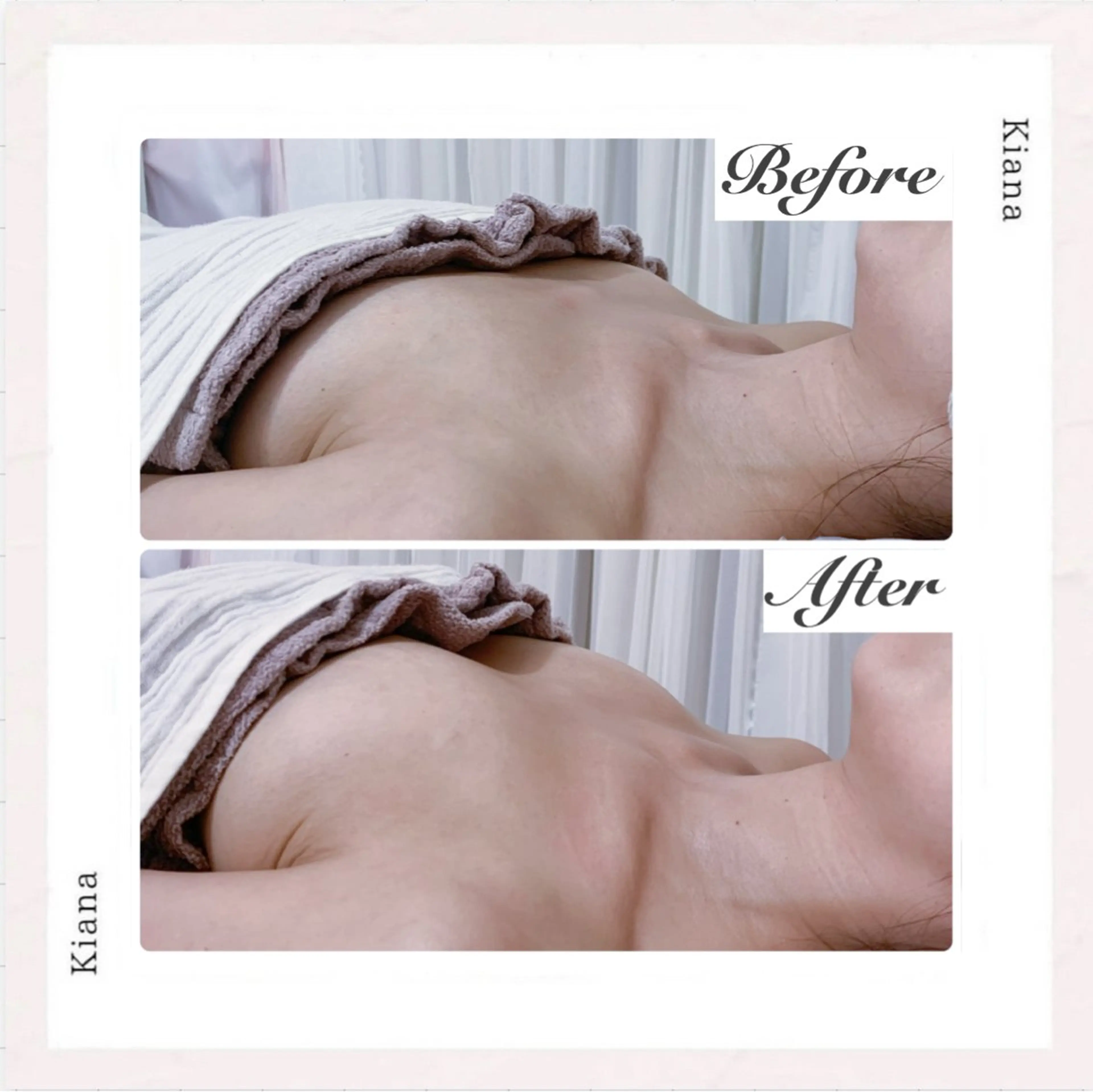 エステ リラク バスト専門Kiana 風のエステ・リラクイメージ