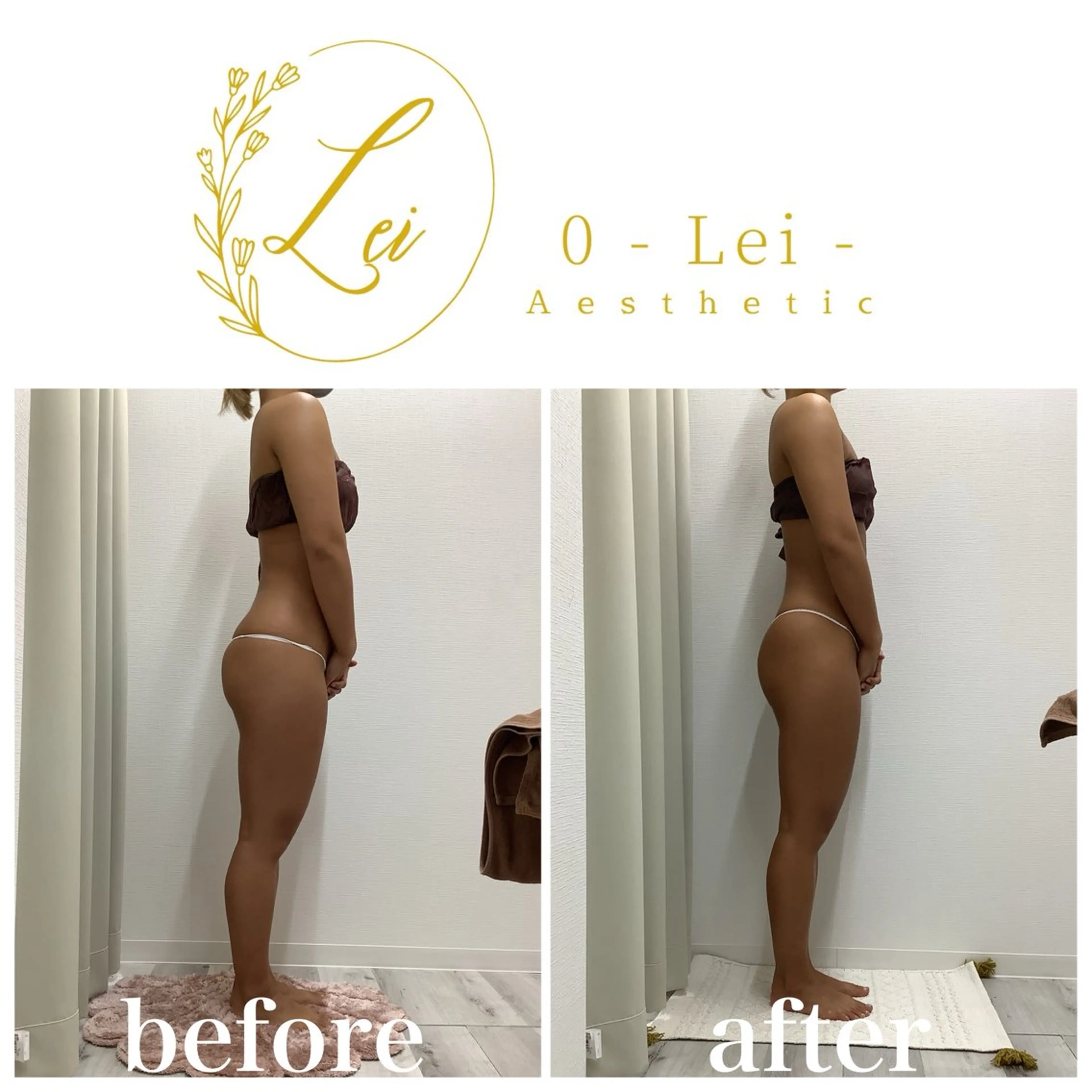 エステ 0-Lei-aesthetic所属・レイエステティック スタッフのエステ・リラクイメージ