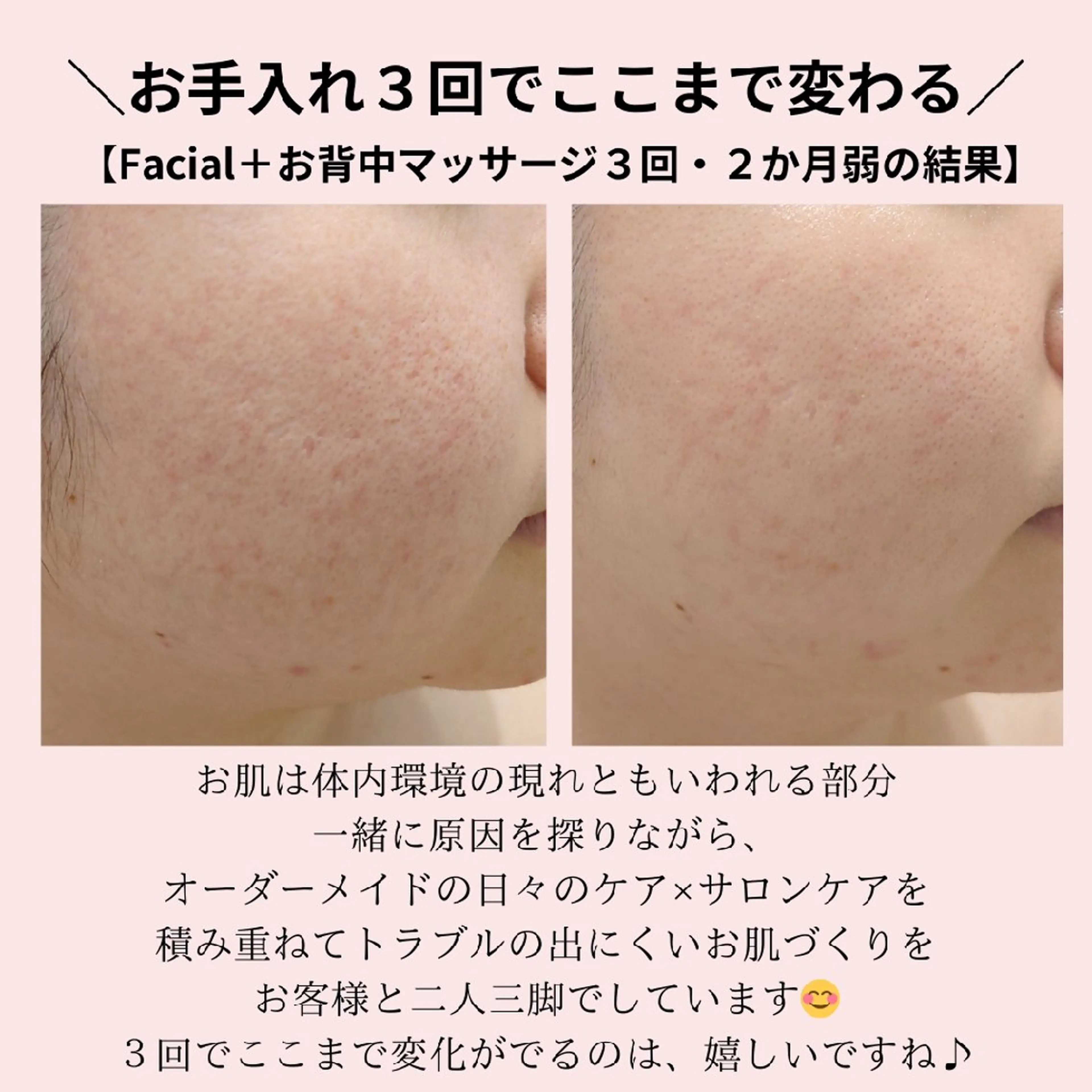 エステ PRETTIEST SHINE所属・山田 浩子のエステ・リラクイメージ