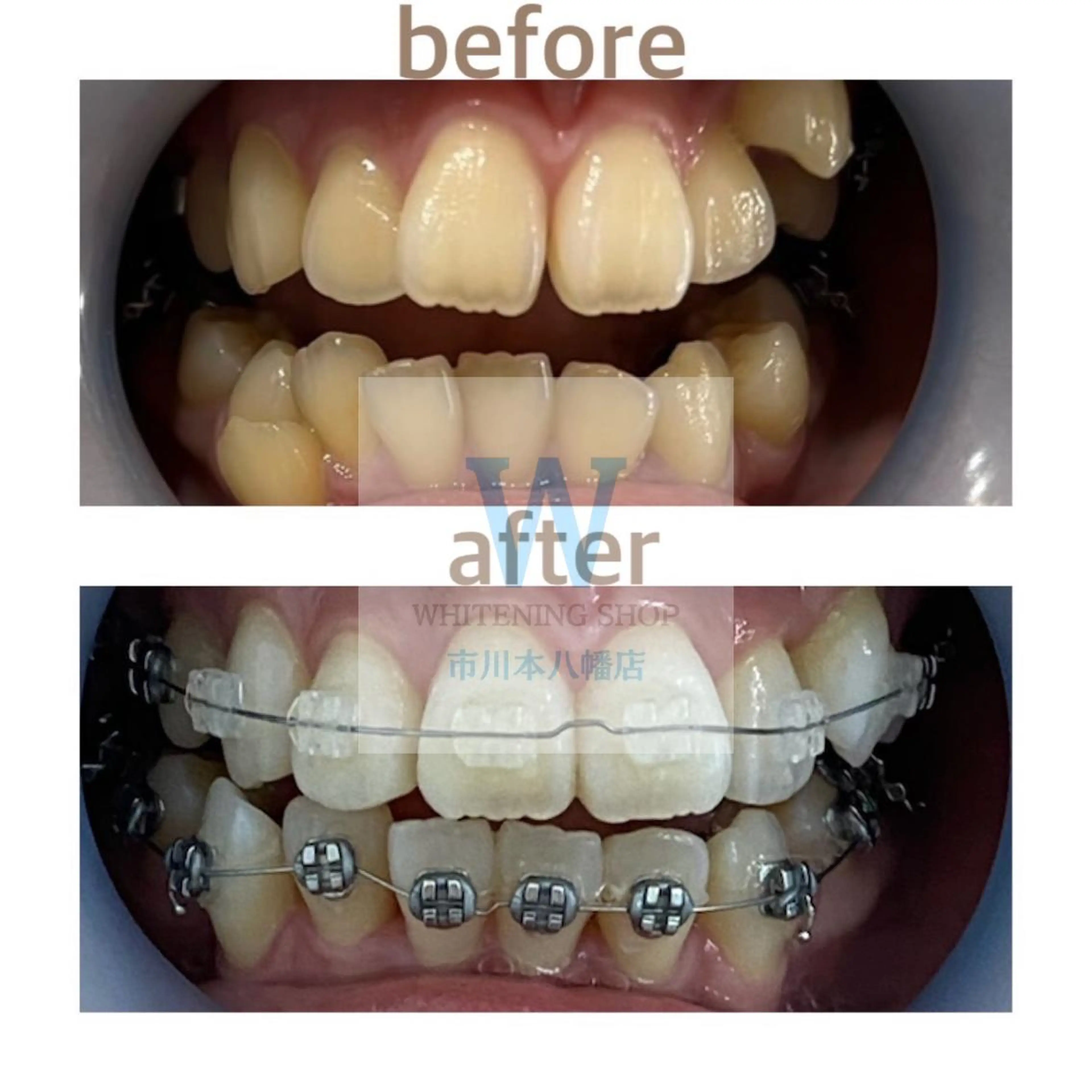 ホワイトニング ショップ本八幡店のエステ・リラクイメージ