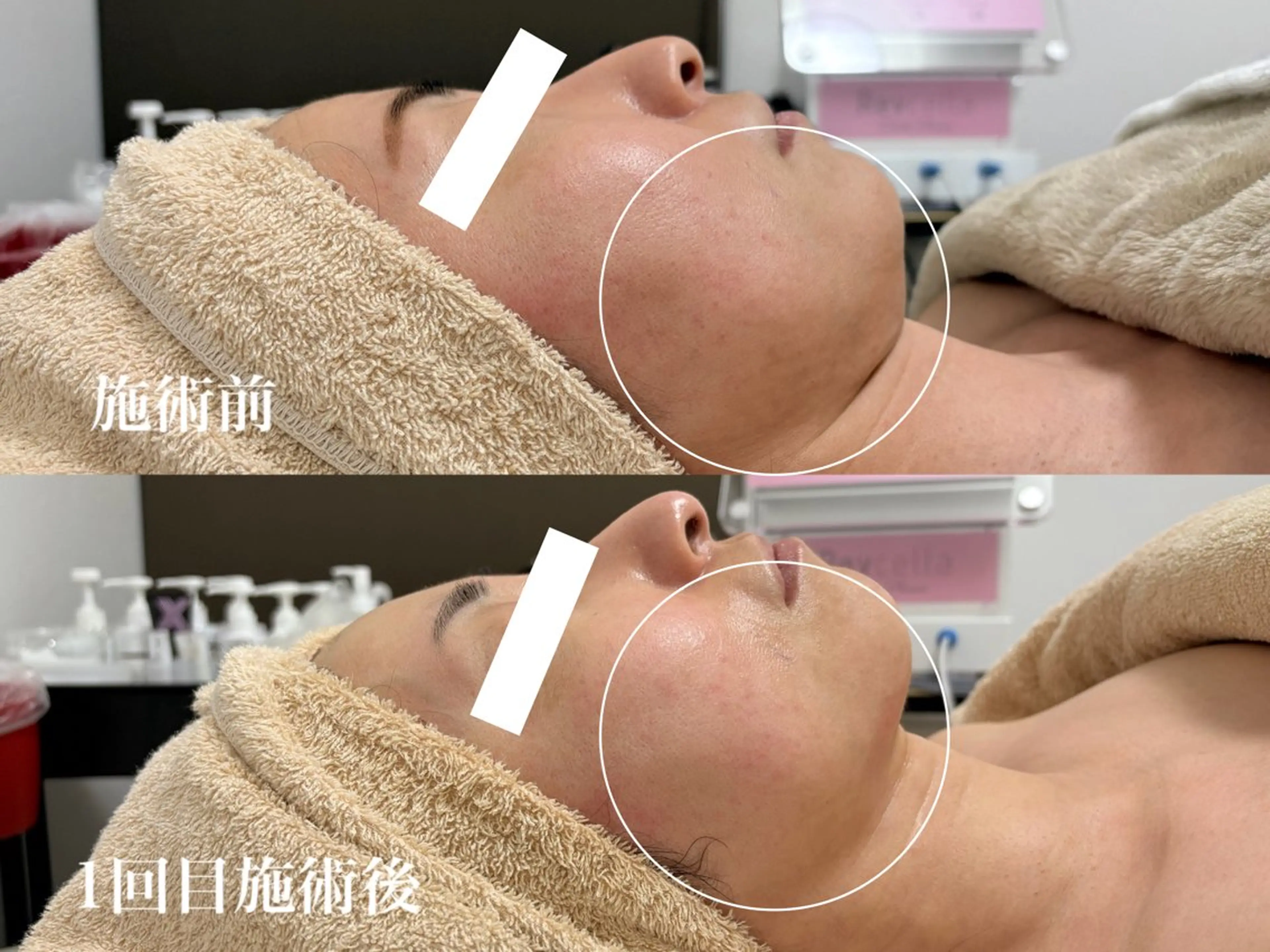 フェイシャルサロンKey of Face所属・村上 貴子のエステ・リラクイメージ