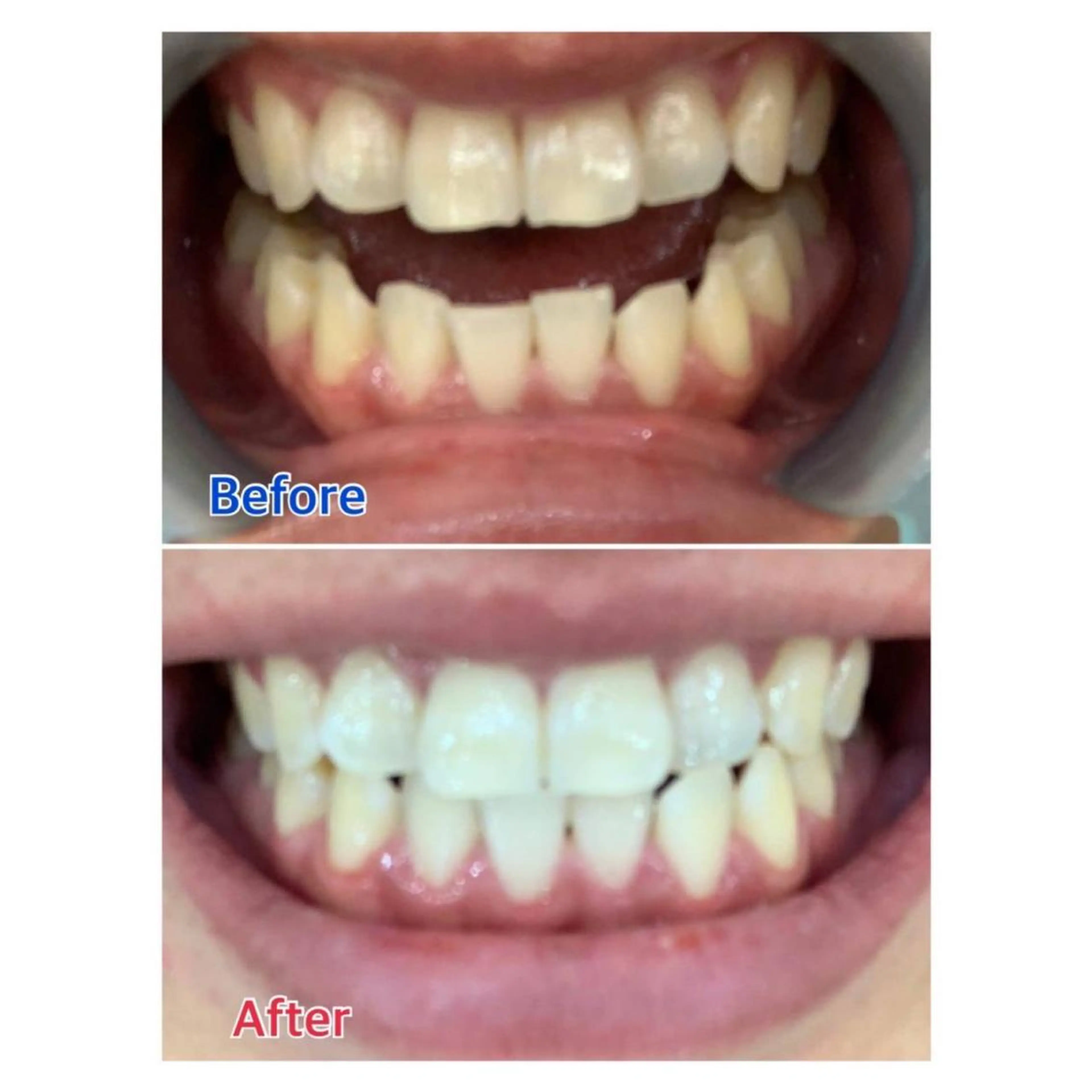 MBEAUTYSALON 千葉店・京成大久保所属・Melty 輝のその他イメージ