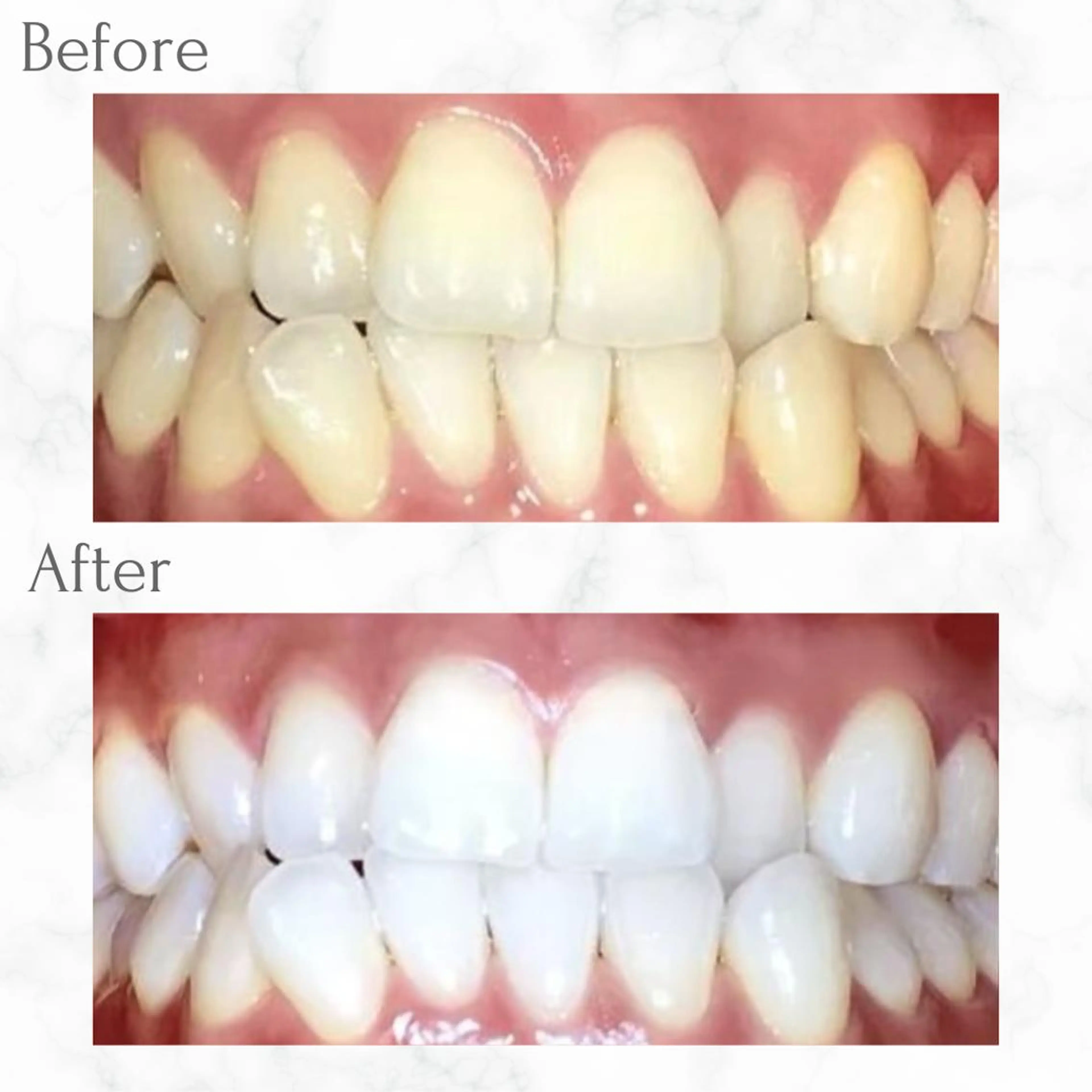 その他 セルフホワイトニング エクシア天神店のその他イメージ