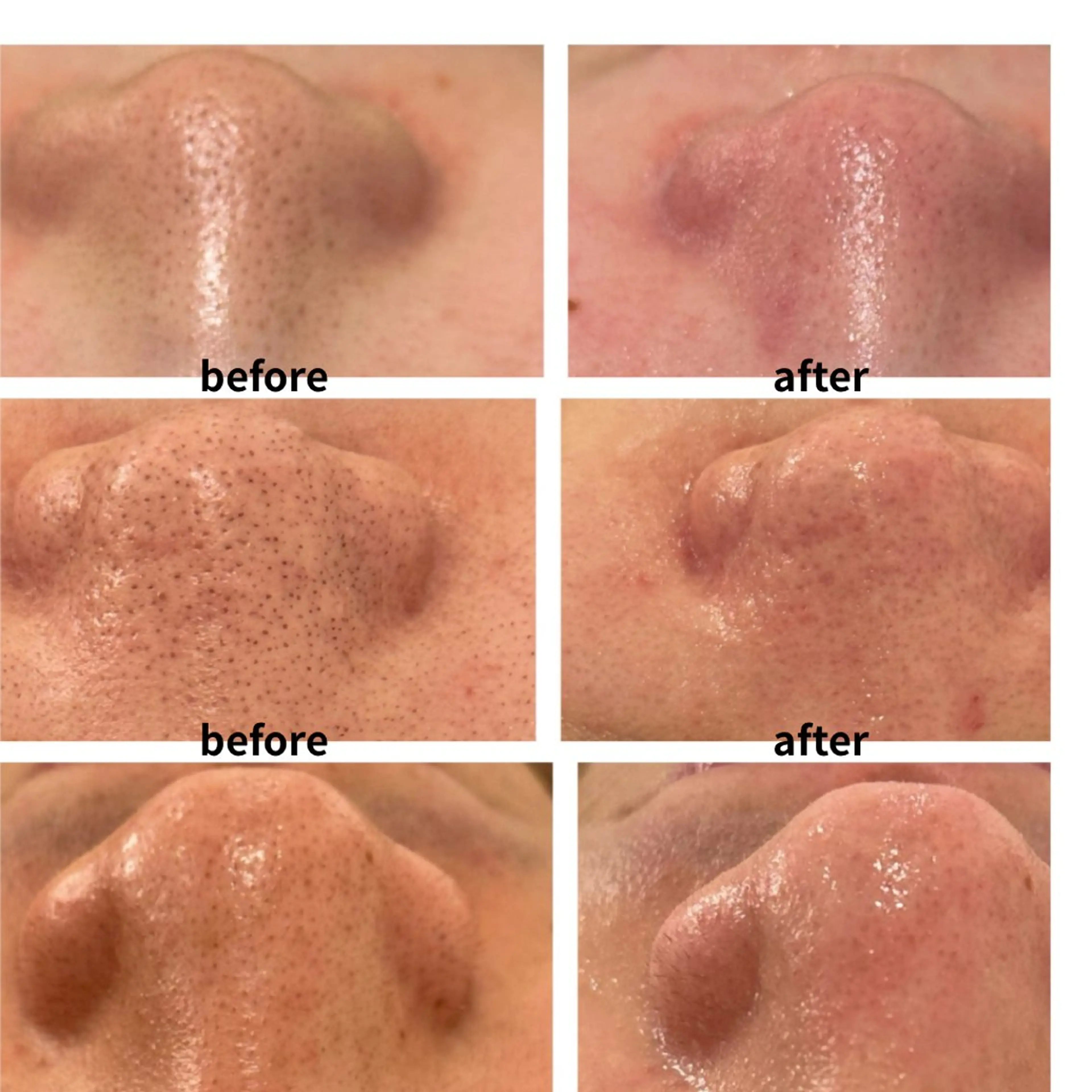 エステ ANERA Second所属・尾上 沙織のエステ・リラクイメージ