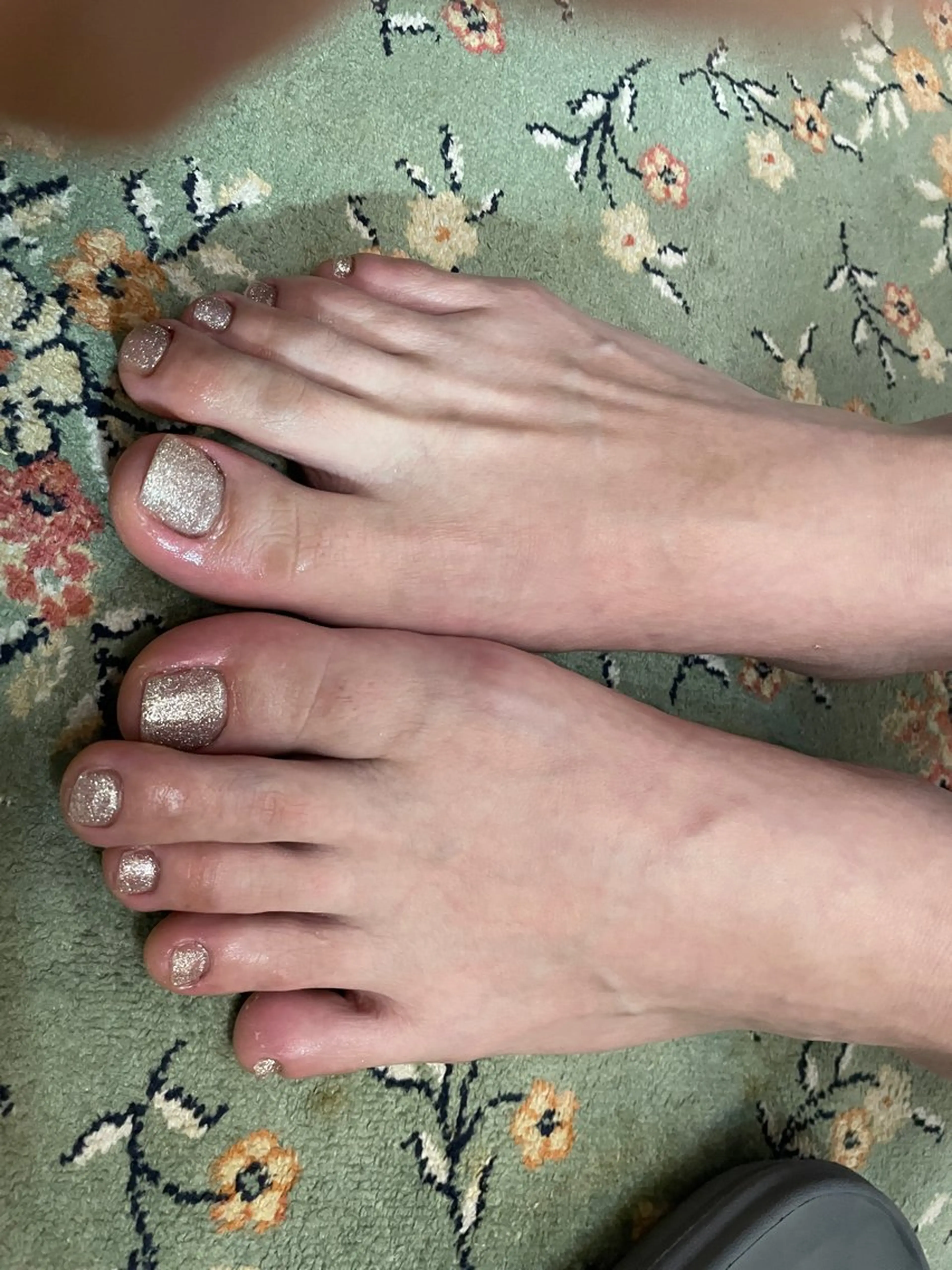 ネイル フットネイル herbal relaxation &beauty満芳庭所属・楊 蓉のネイルデザイン