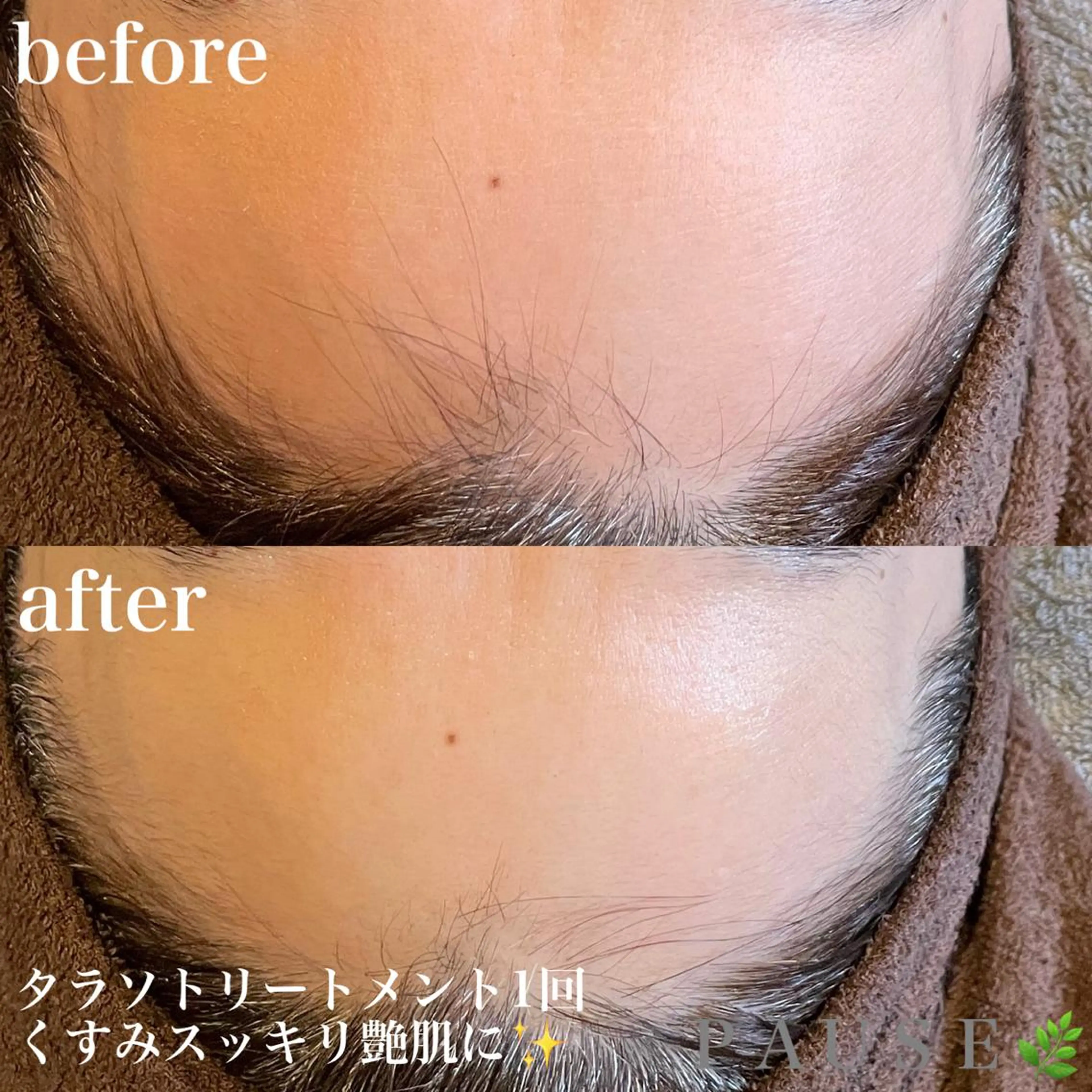 エステ 浜野 恵美のエステ・リラクイメージ