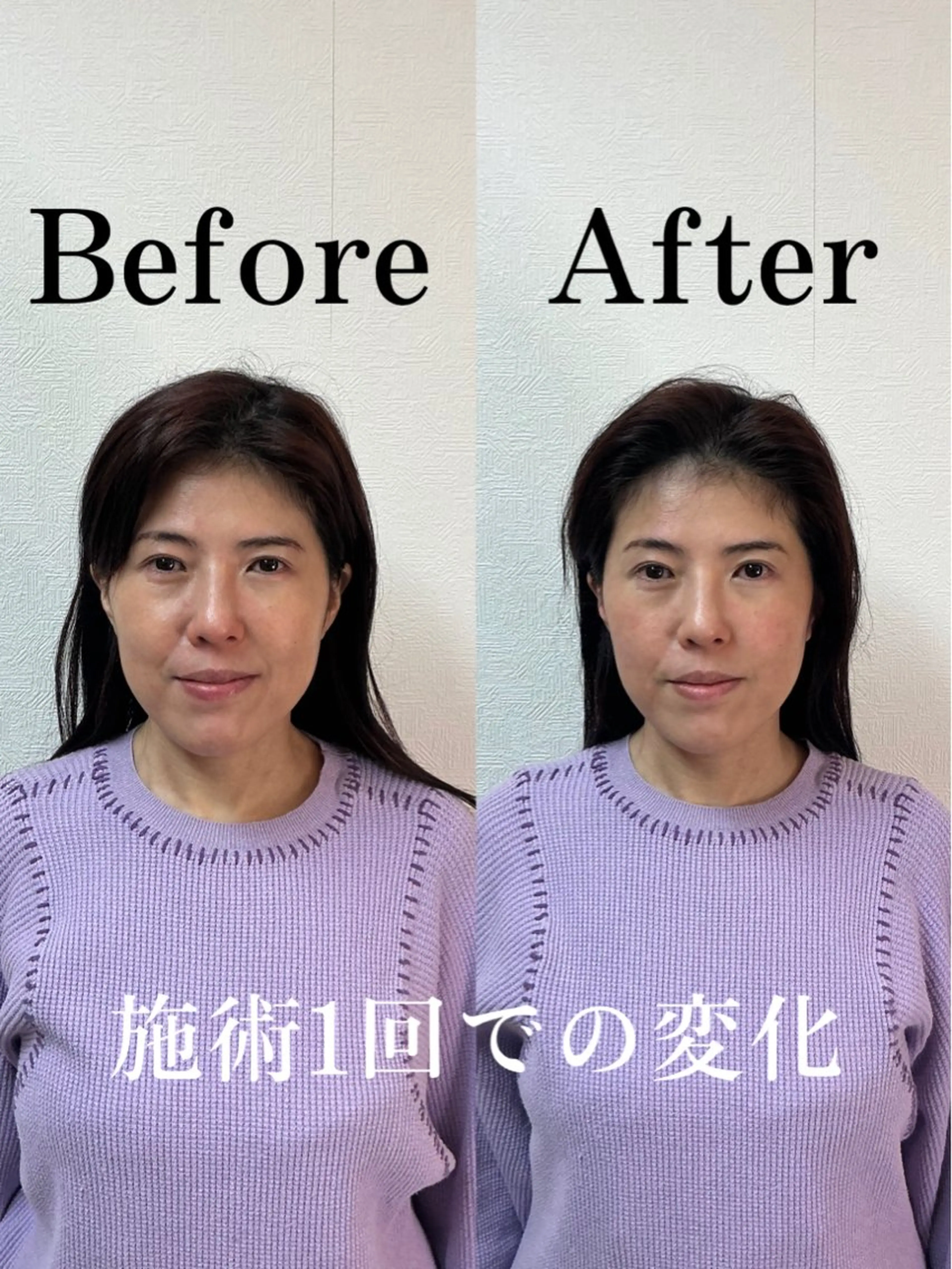 顔の整体 Nefert【ネフェルト】所属・こやま りょうのエステ・リラクイメージ