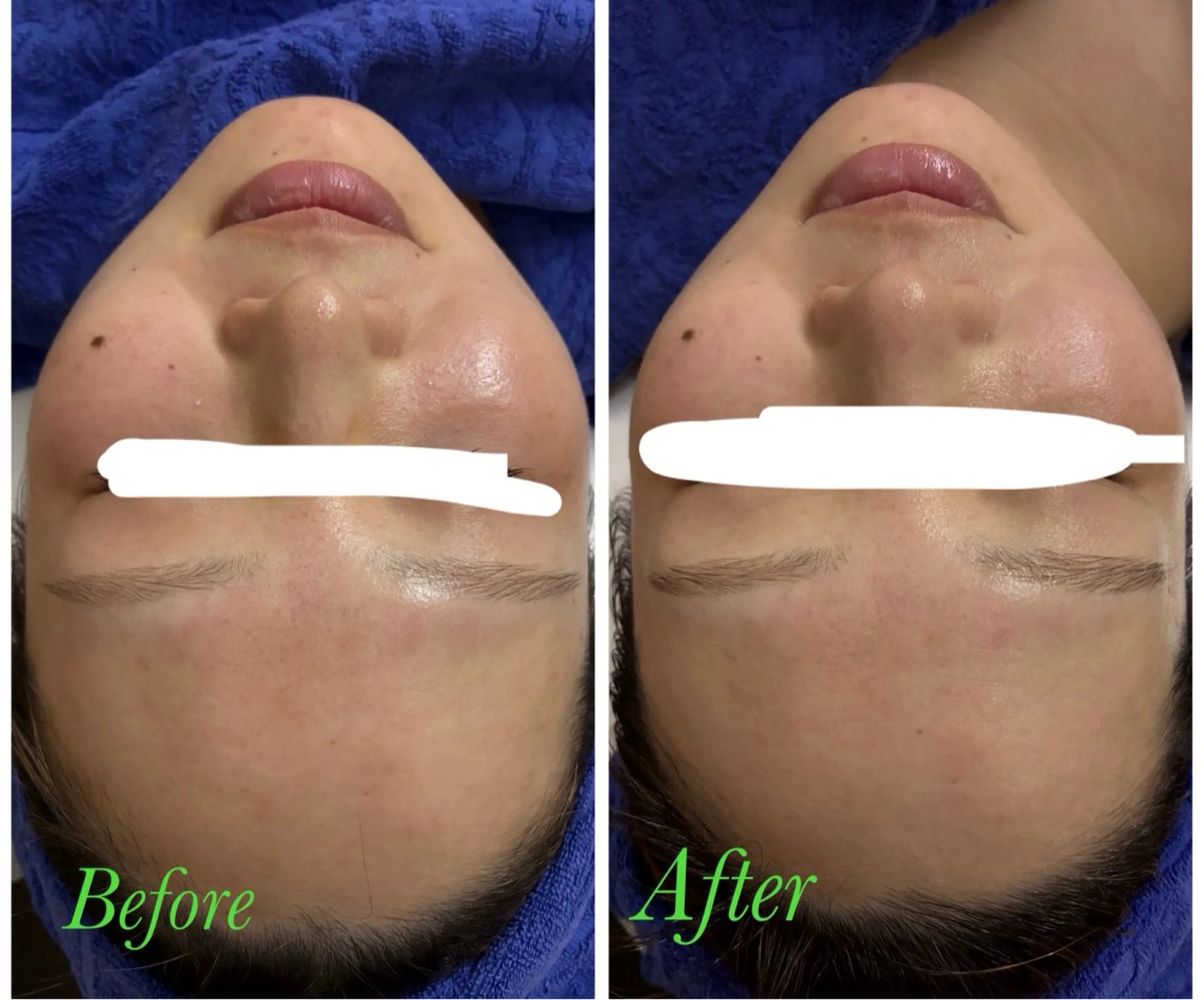 エステ ビューティーサロン　プリズム所属・久留本 茜のエステ・リラクイメージ