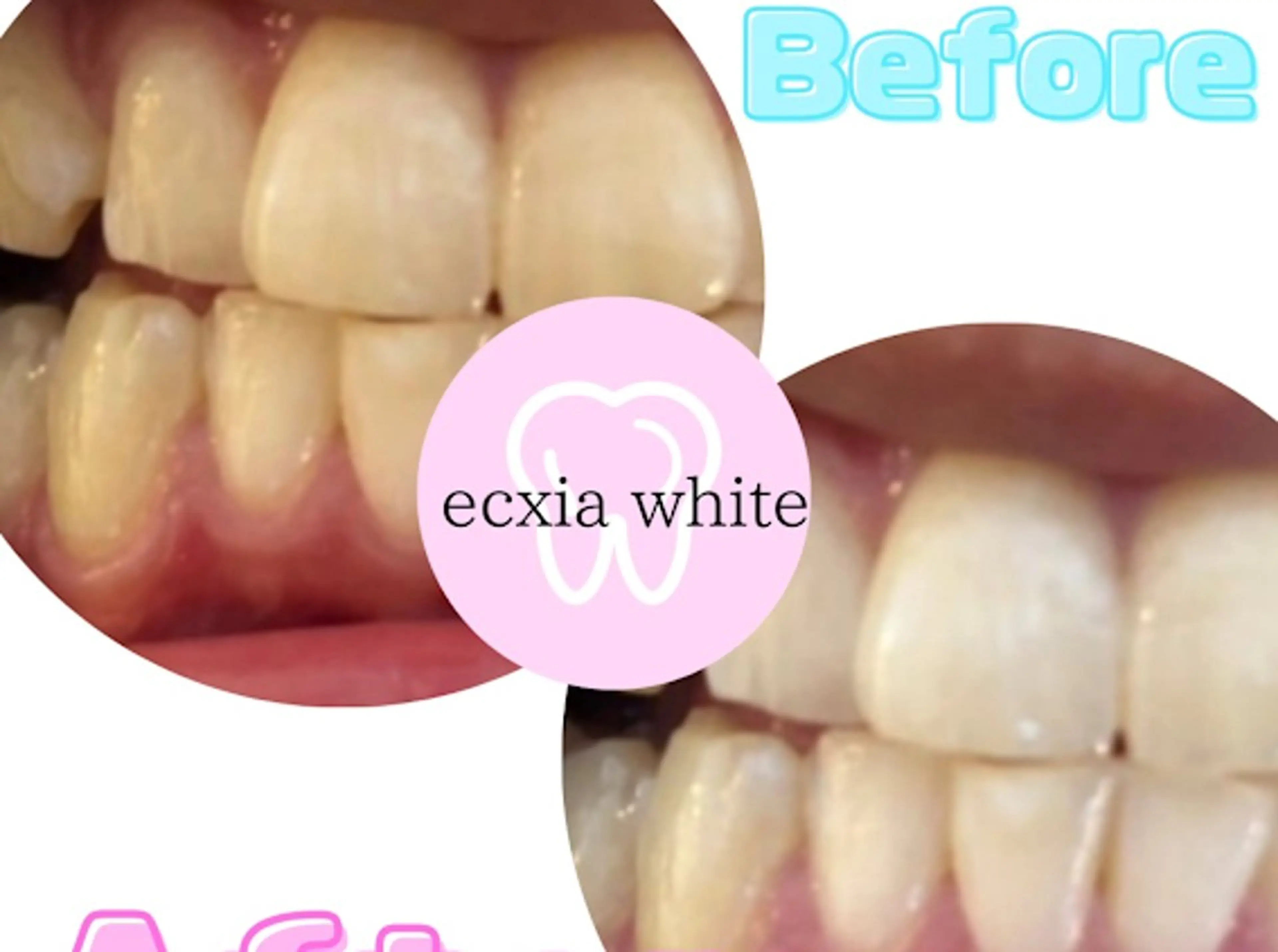 セルフホワイトニングサロン　エクシアホワイト西尾店所属・エクシアホワイト西尾 堀内恵のその他イメージ