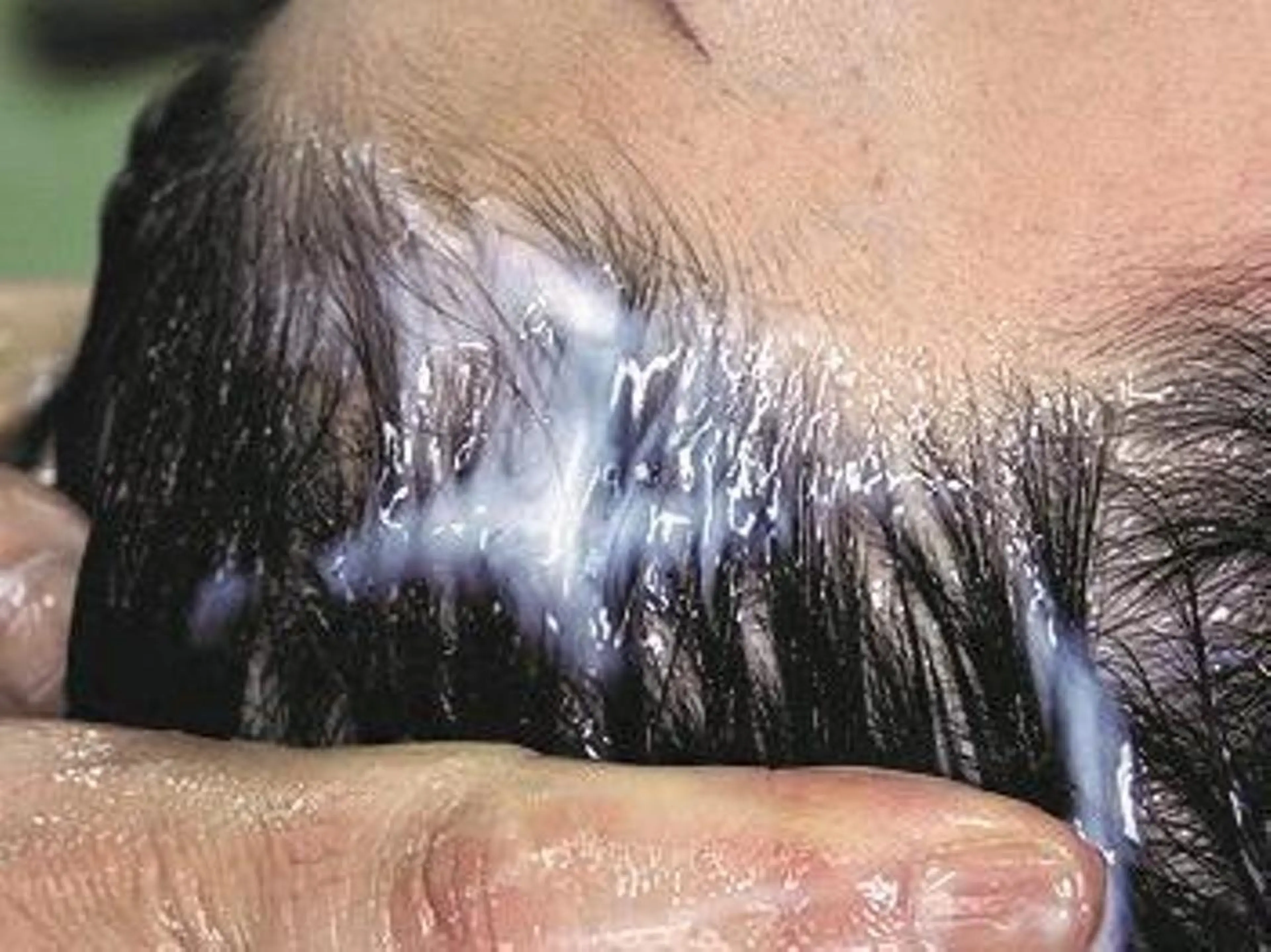 スキャルプケア１回￥16500の写真