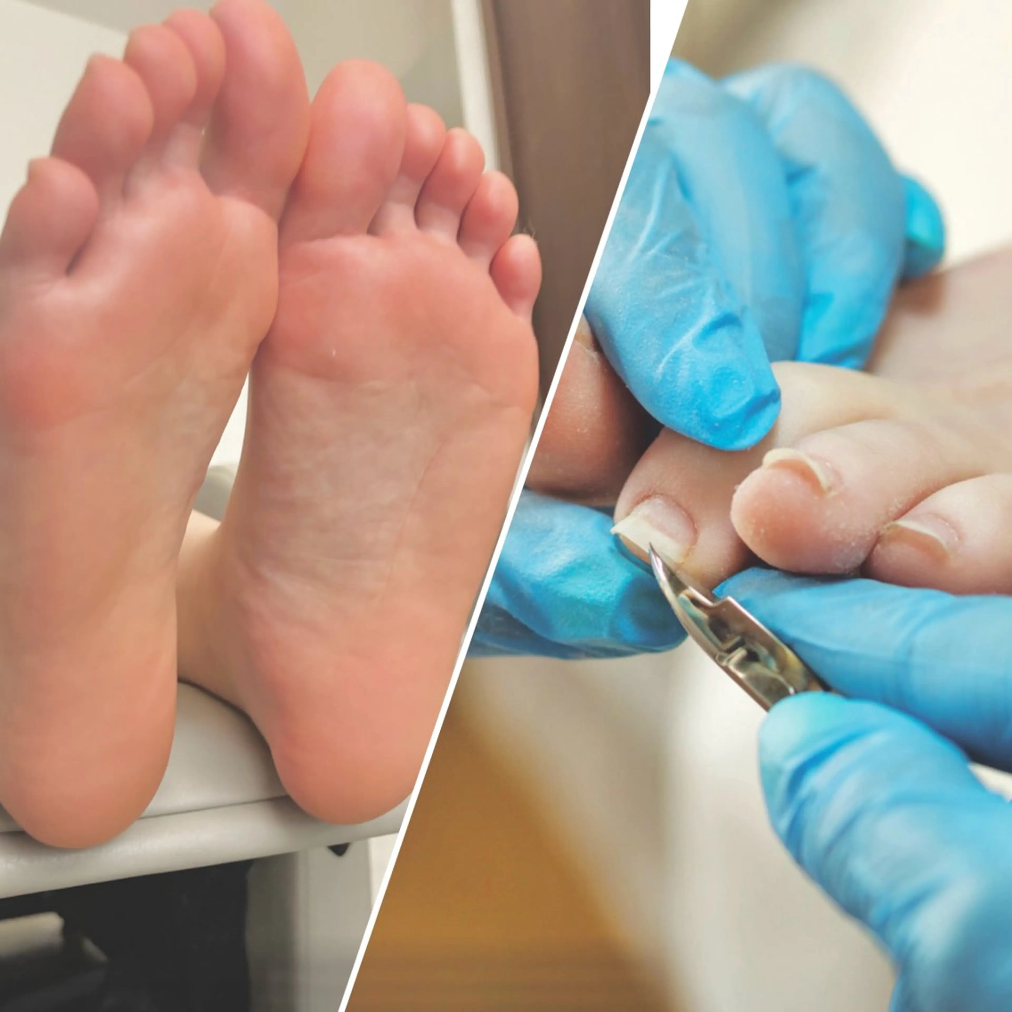 【足裏角質ケア➕甘皮ケア】お爪の形も整えながら、足裏のガサガサかかとを除去♪夏前に一度にまとめて理想の足元ケアが叶う★の写真