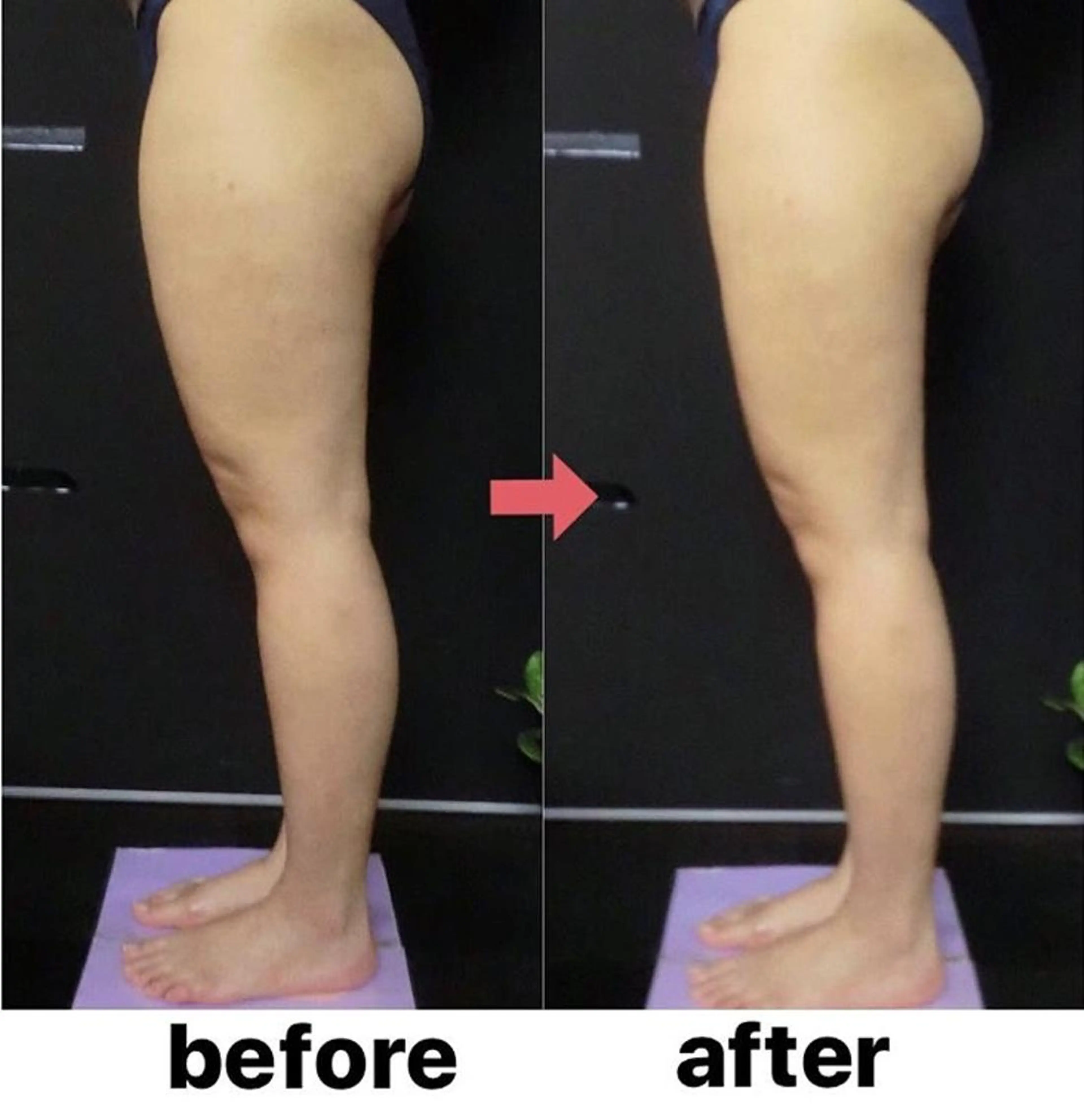 横浜エステサロン R-ing リングのエステ・リラクイメージ