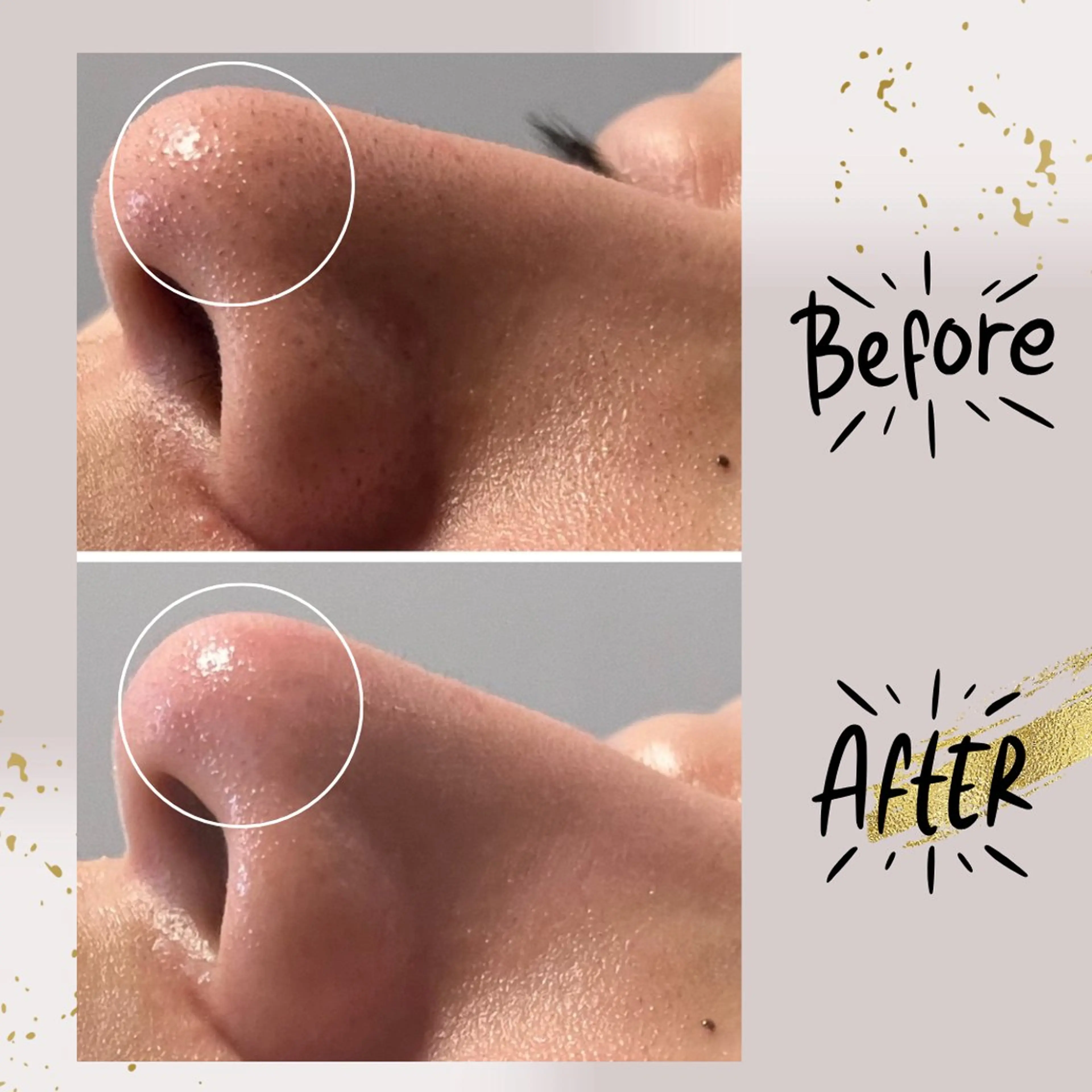 ピーリング専門店 Belluteのエステ・リラクイメージ