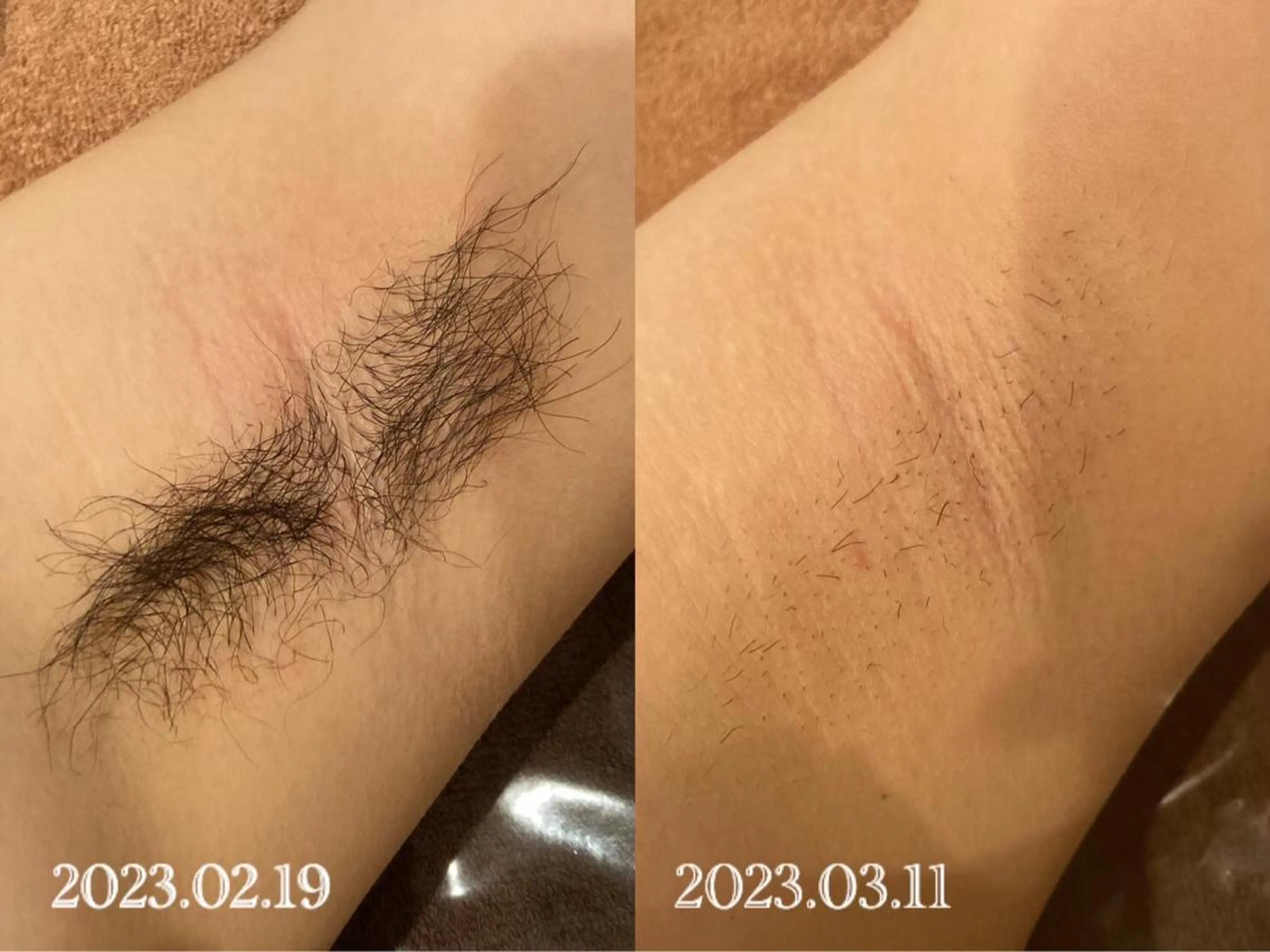 脱毛 美肌脱毛専門店 ディオーネ四日市店のエステ・リラクイメージ