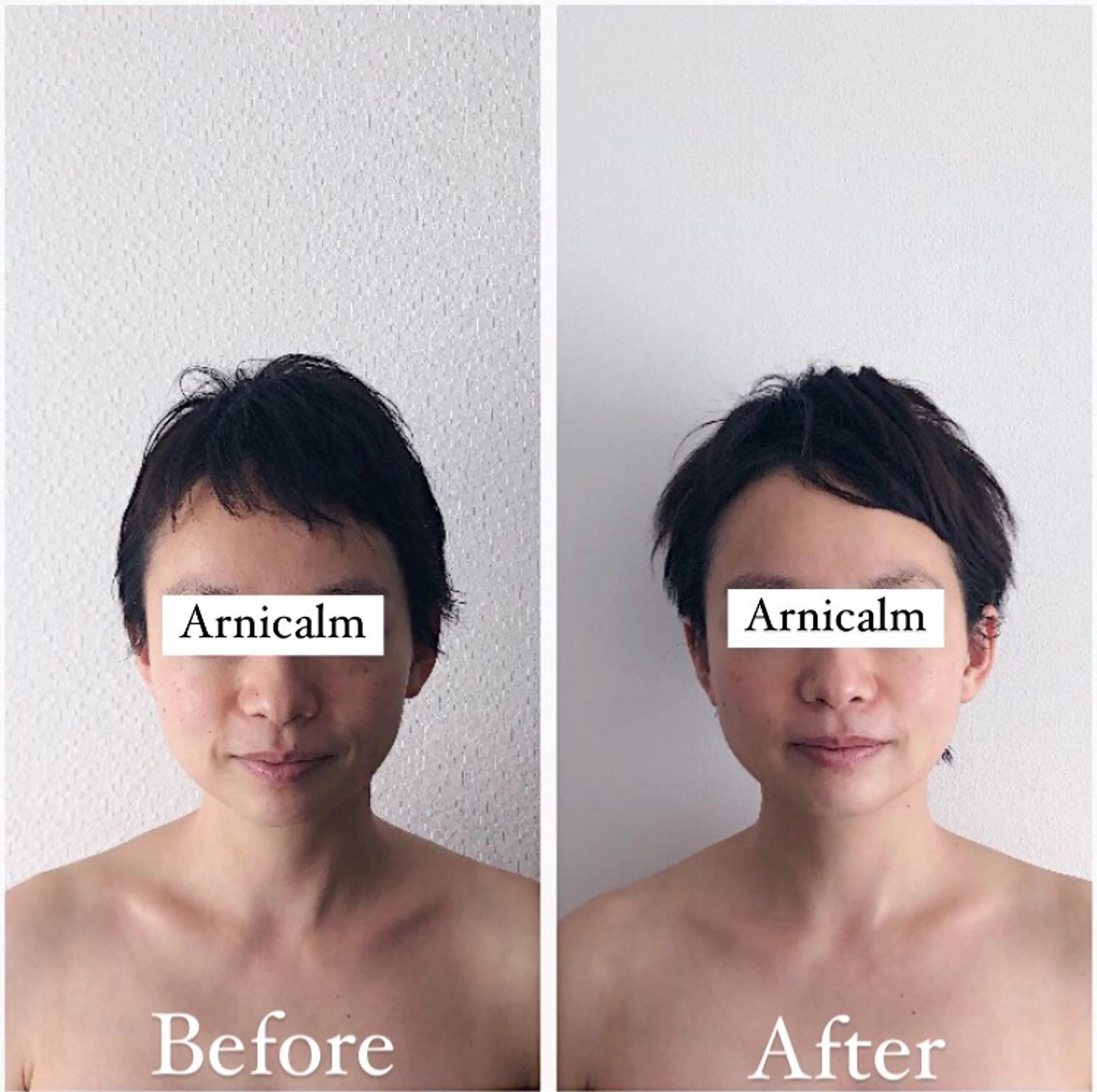 エステ ハーブピーリング 肌再生ピーリング/のエステ・リラクイメージ