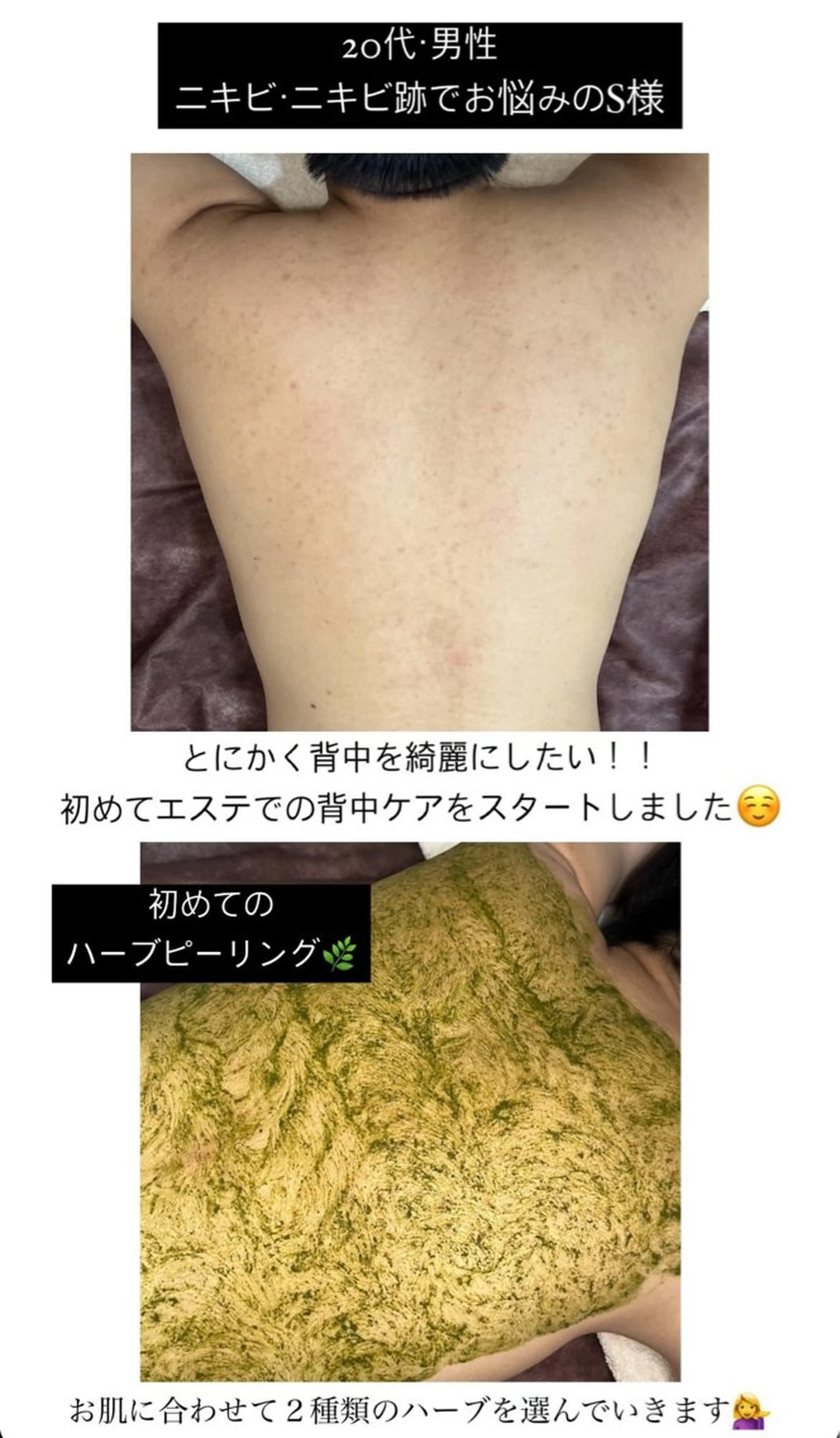 エステ ベラージュ【美背中・ 美尻・フェイシャル】のエステ・リラクイメージ