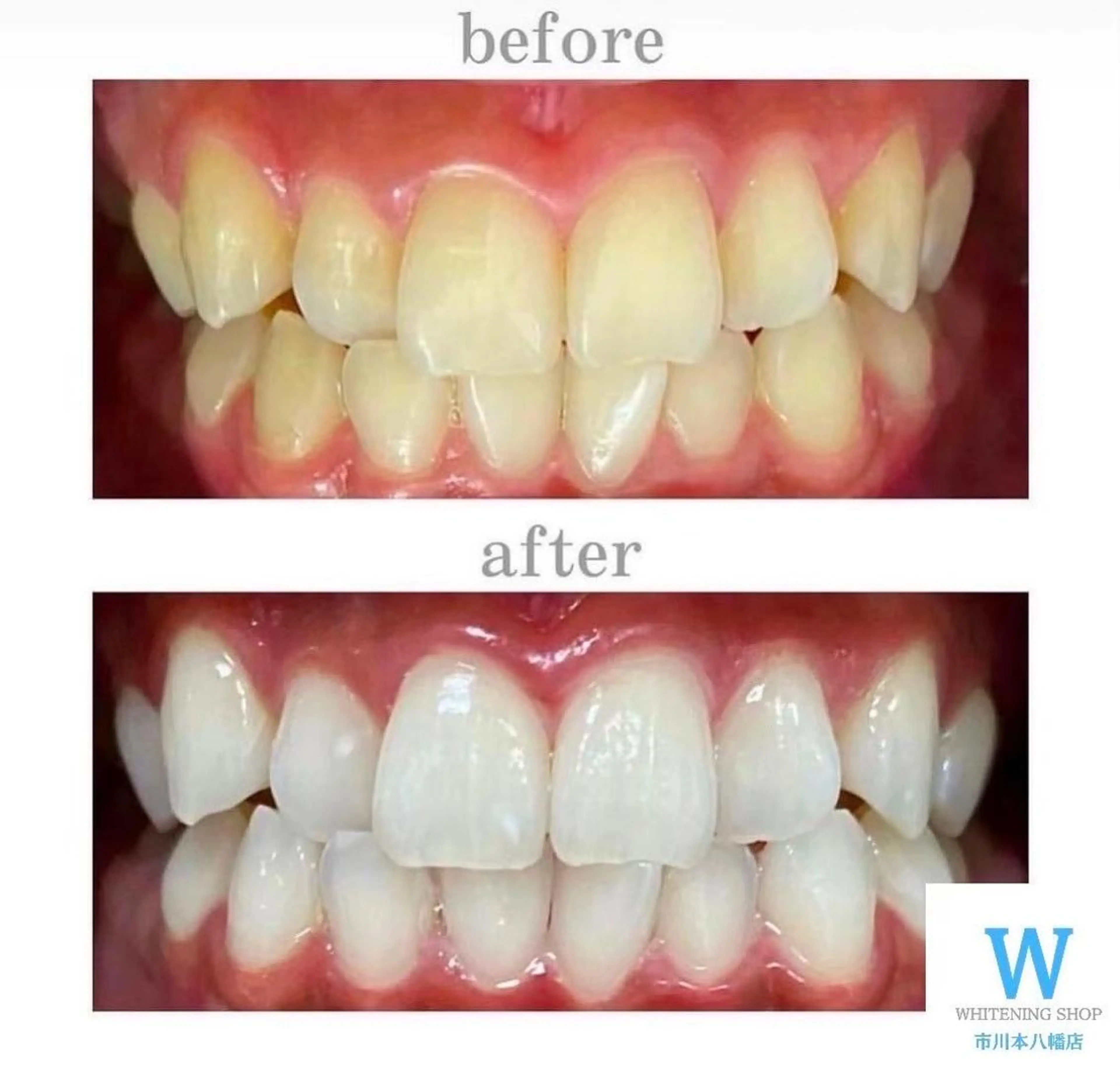 ホワイトニング ショップ本八幡店のエステ・リラクイメージ