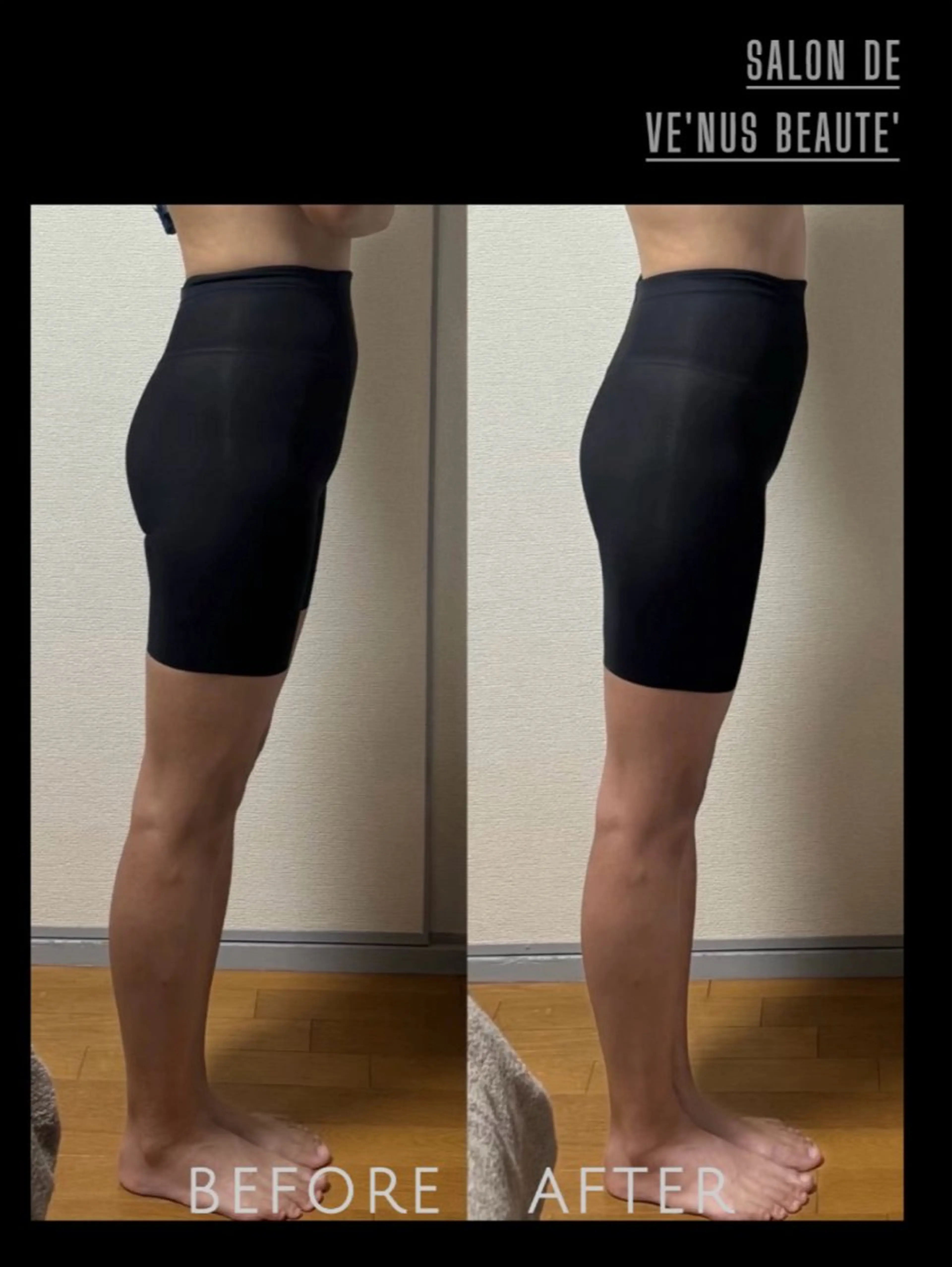 その他 ヴィーナス ビューティーのエステ・リラクイメージ