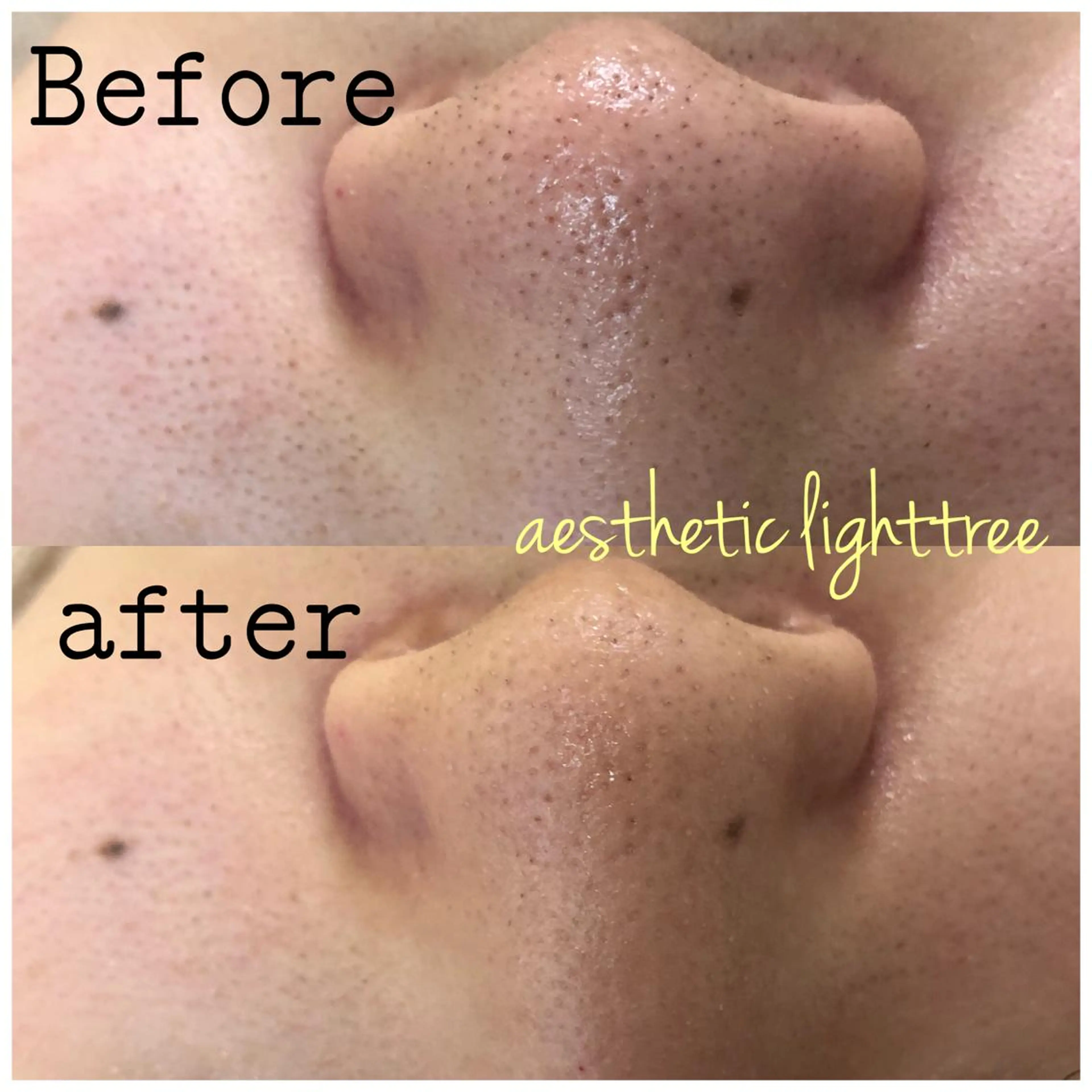 ショート カラー パーマ ヘアアレンジ メンズ キッズ エステ ニキビ&跡改善サロン オーナー光木のエステ・リラクイメージ