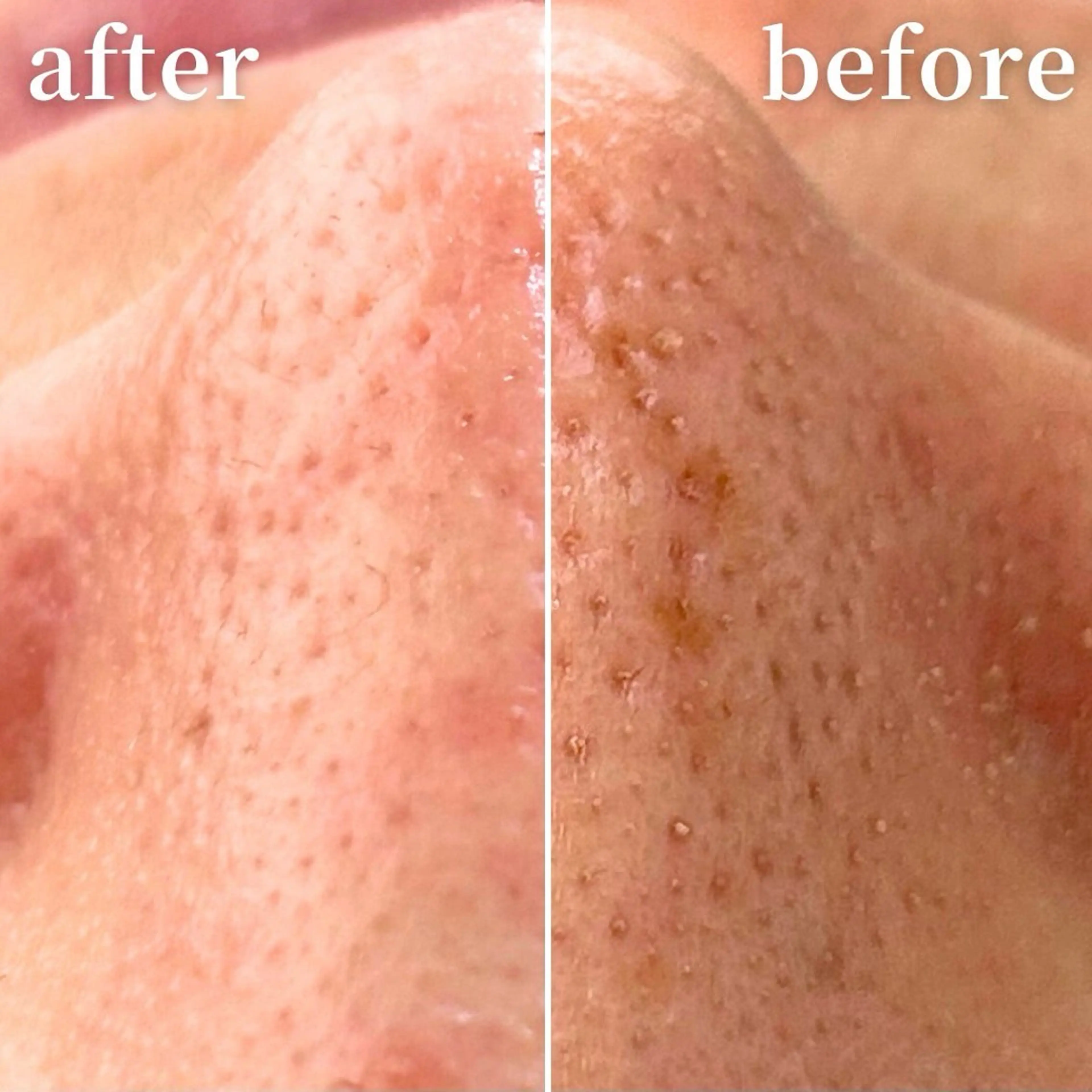 毛穴専門サロンLatiele所属・毛穴専門サロン Latieleのエステ・リラクイメージ