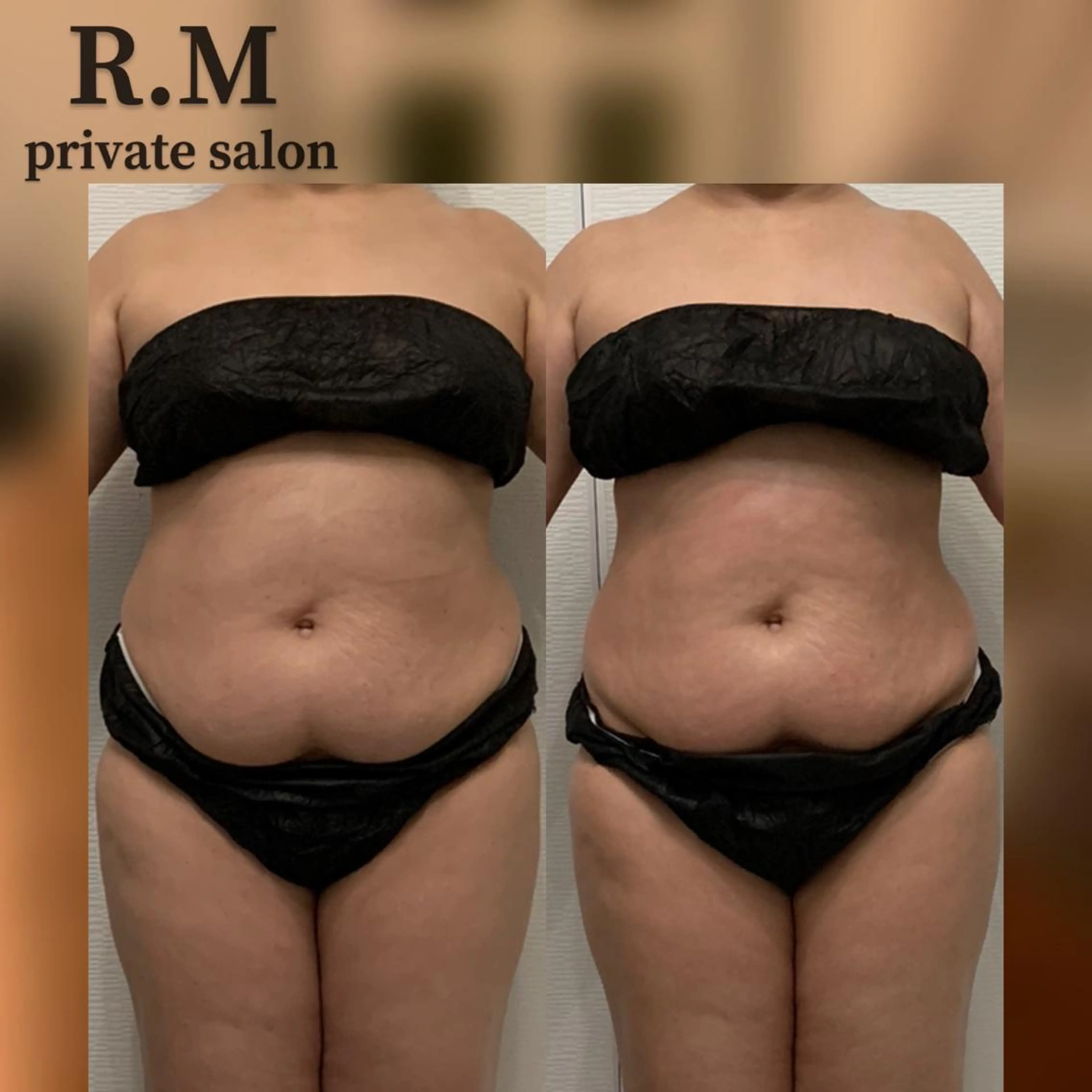 R.M所属・プライベートサロン R.Mのエステ・リラクイメージ