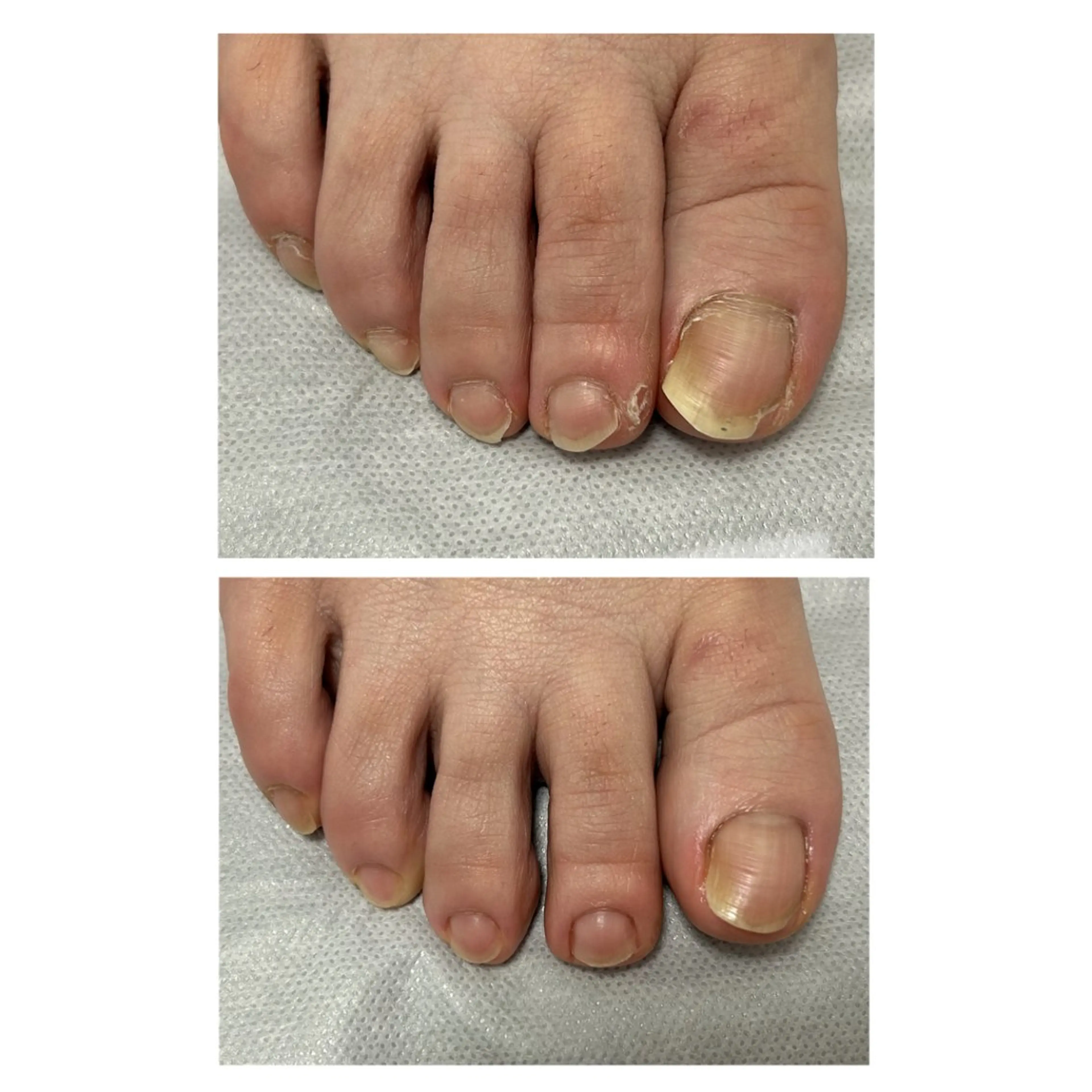 その他 なが さきのネイルデザイン