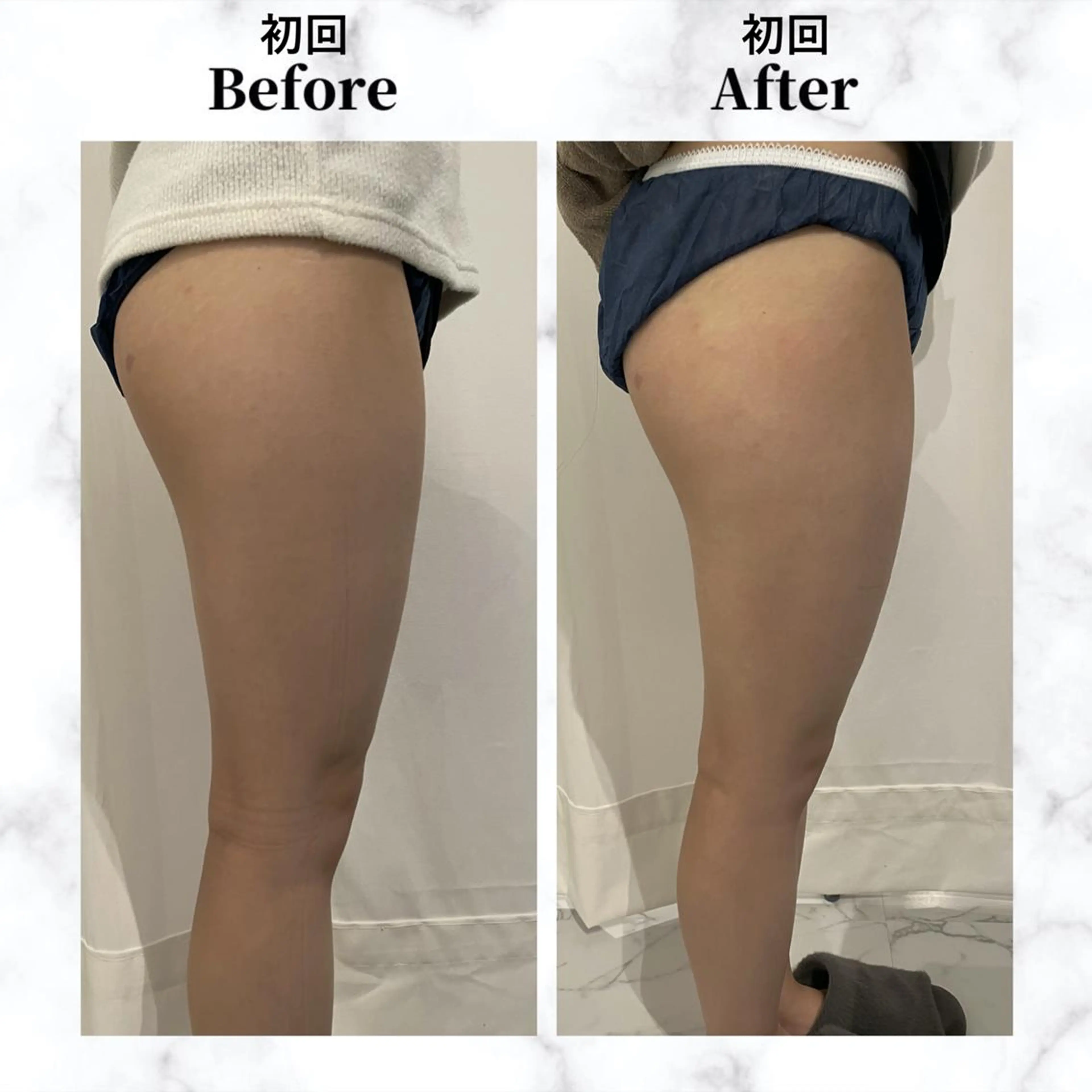 エステ リラク 12Dハイフ💗 最強小顔のエステ・リラクイメージ