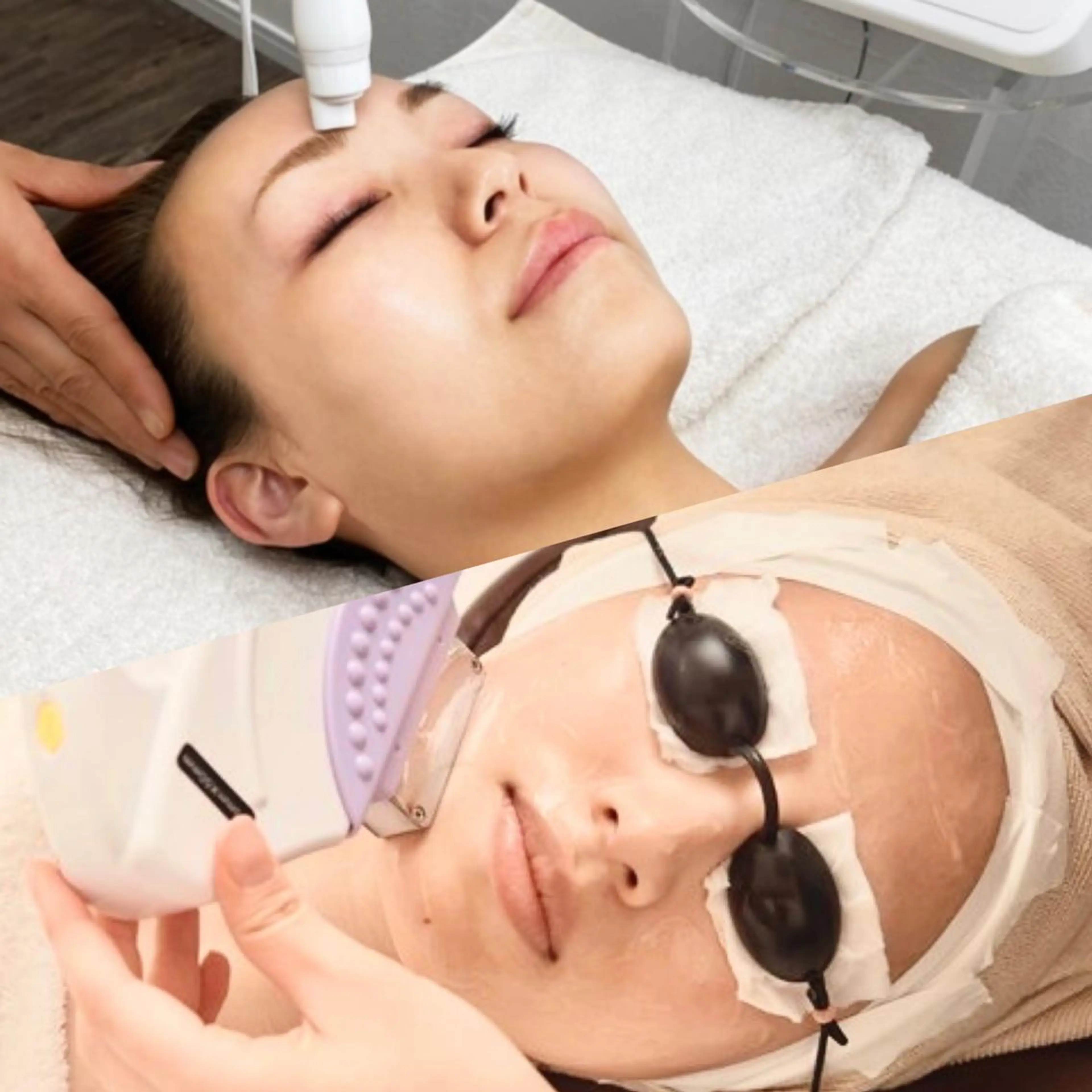 【毛穴・小じわ・たるみケア】毛穴洗浄＋IPL光フェイシャル ¥23,000→¥14,000の写真