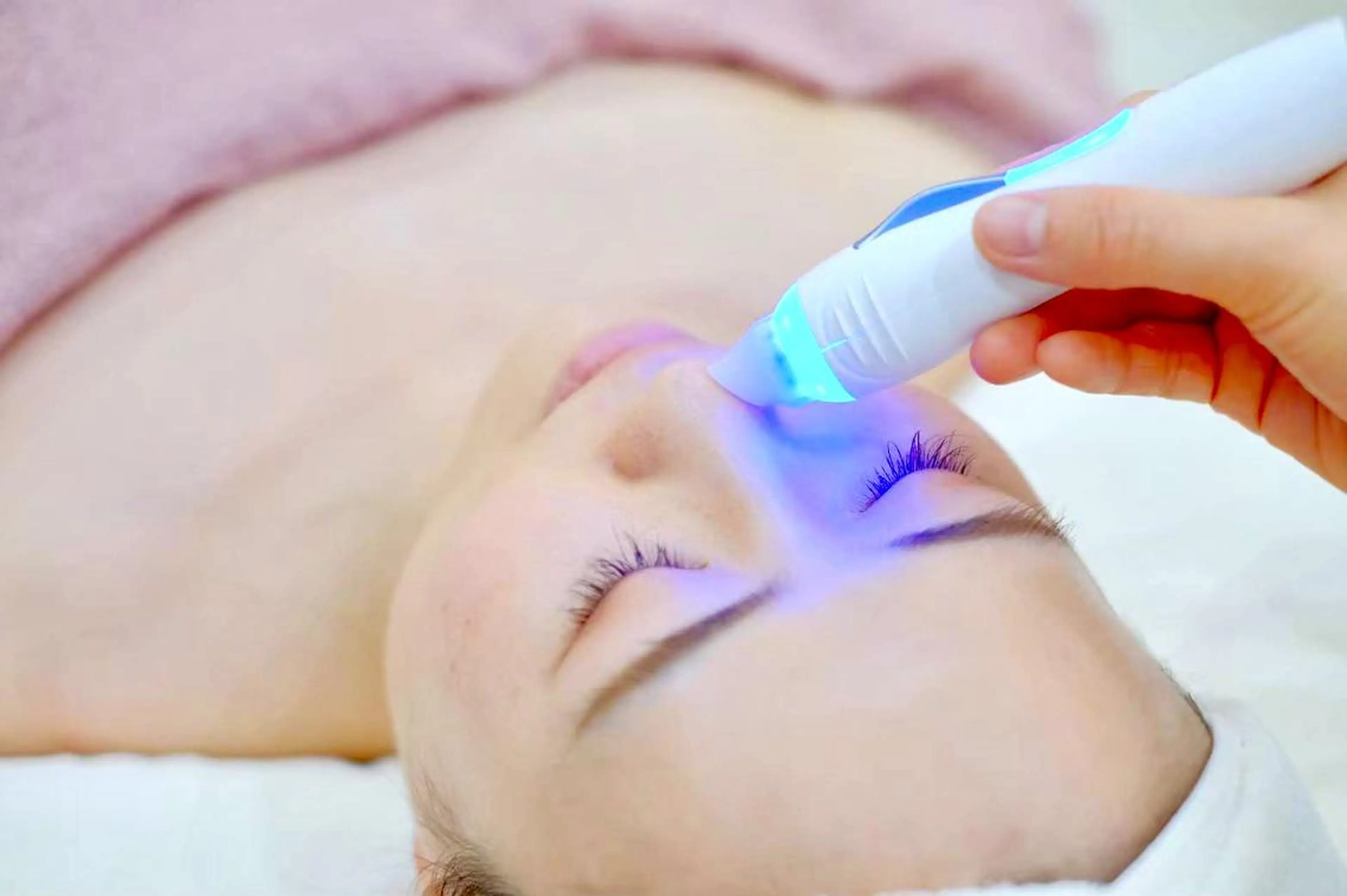 【毛穴改善】人気NO.3黒ずみごっそり! やみつきハイドラ肌分析付50分の写真