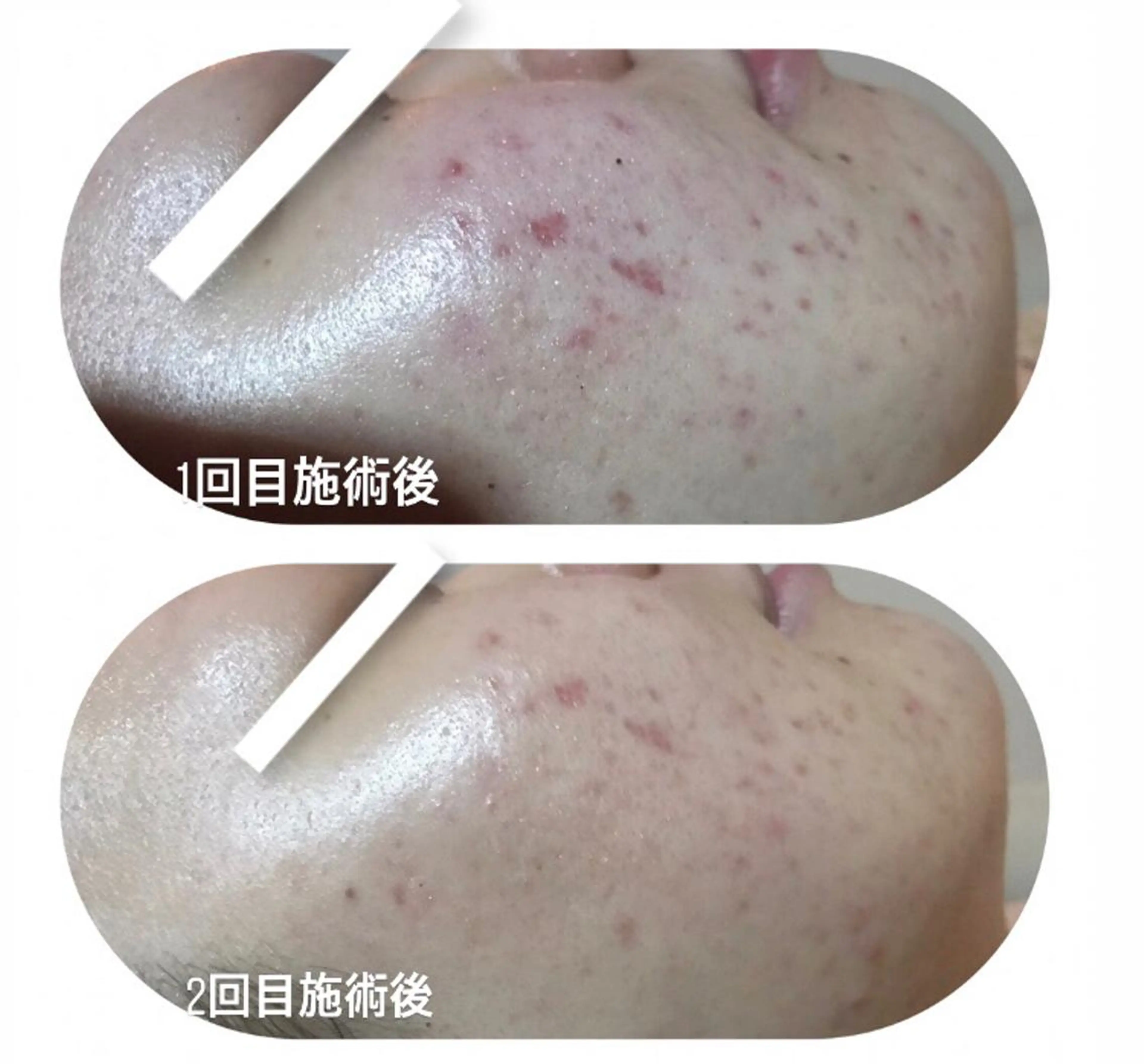 エステ 【足圧】鬼👹リンパ 身体整うサロンのエステ・リラクイメージ