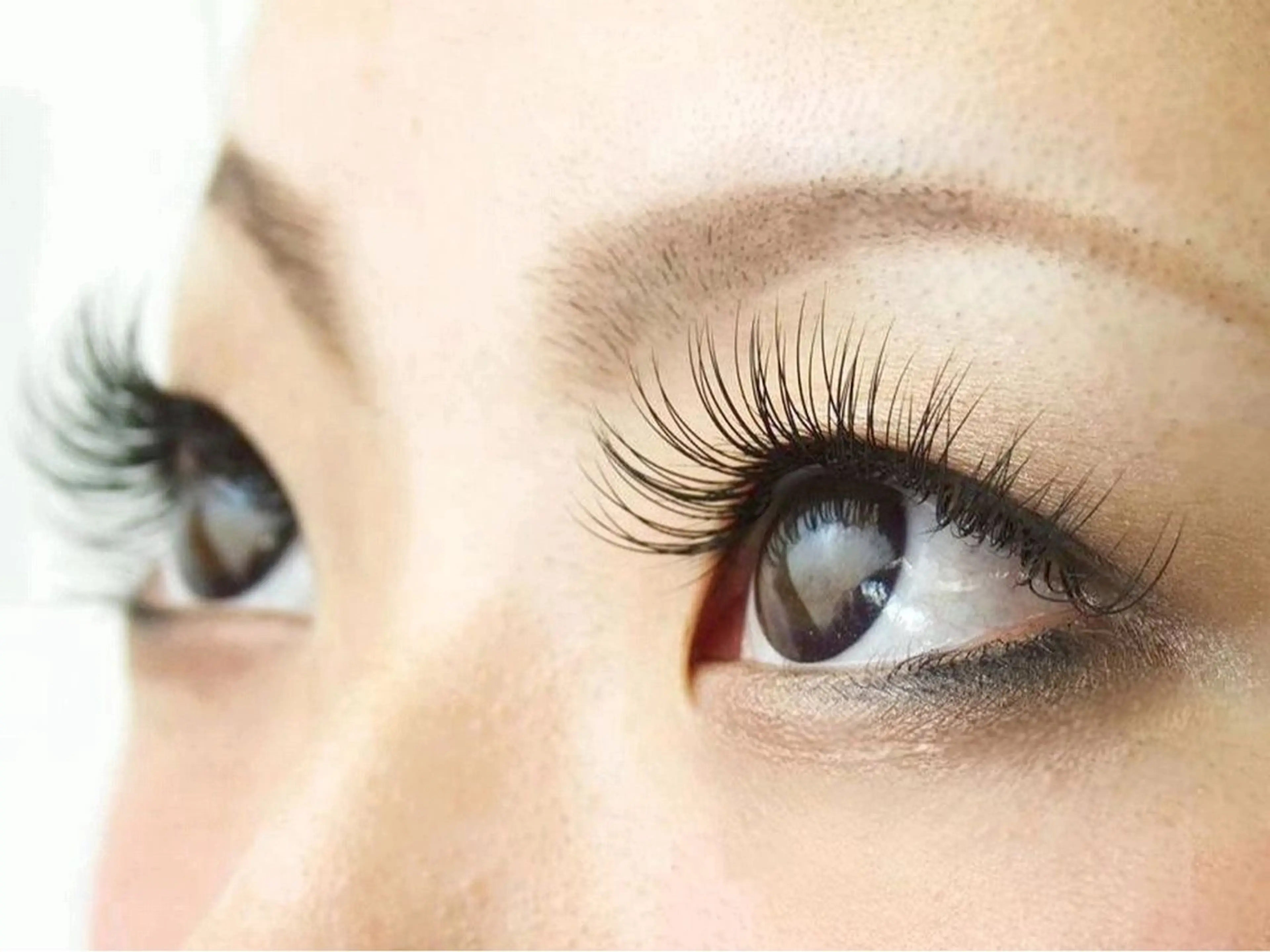 フラットラッシュ100本の写真