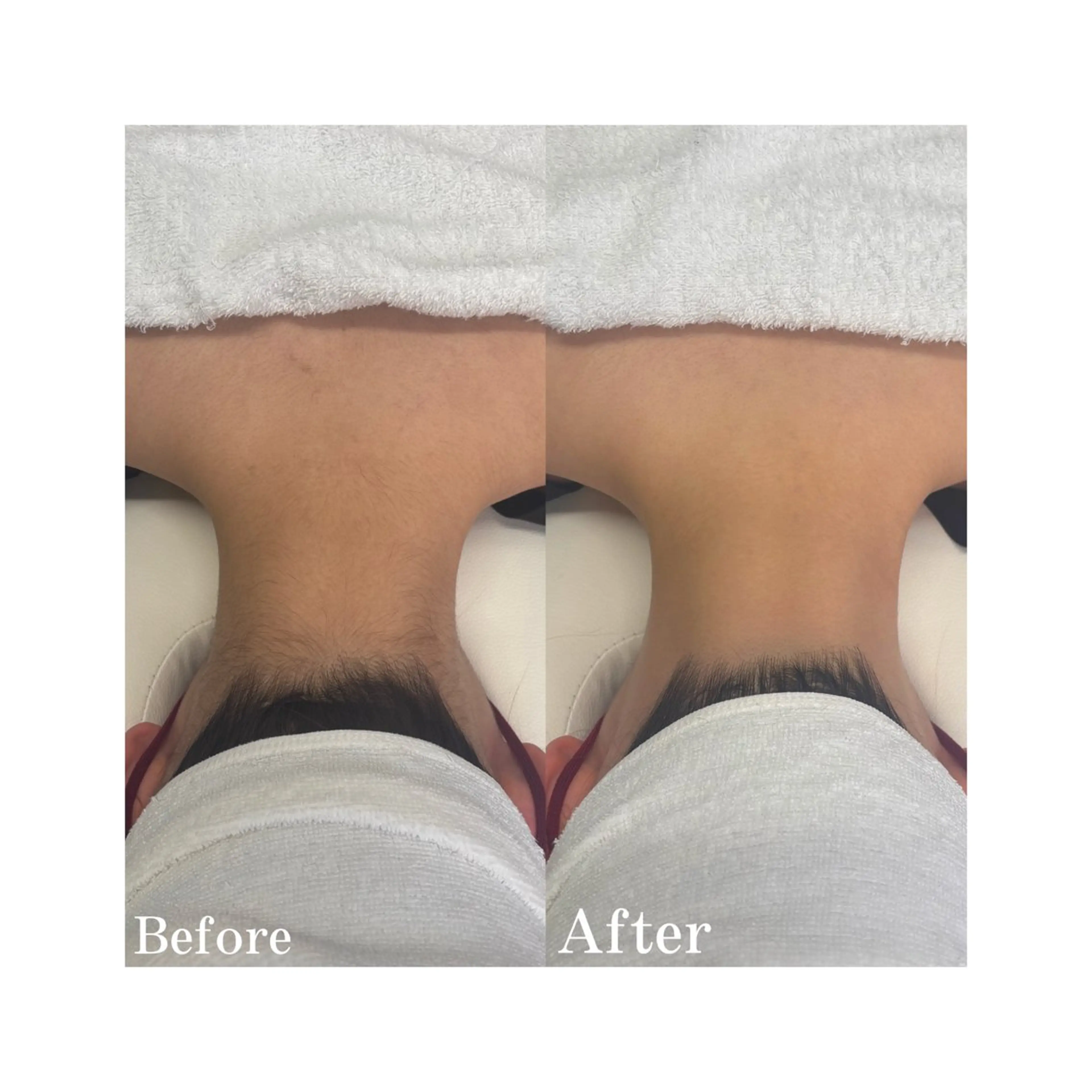 脱毛 サキ 脱毛.エステ🩵ྀིの眉毛・アイブロウイメージ