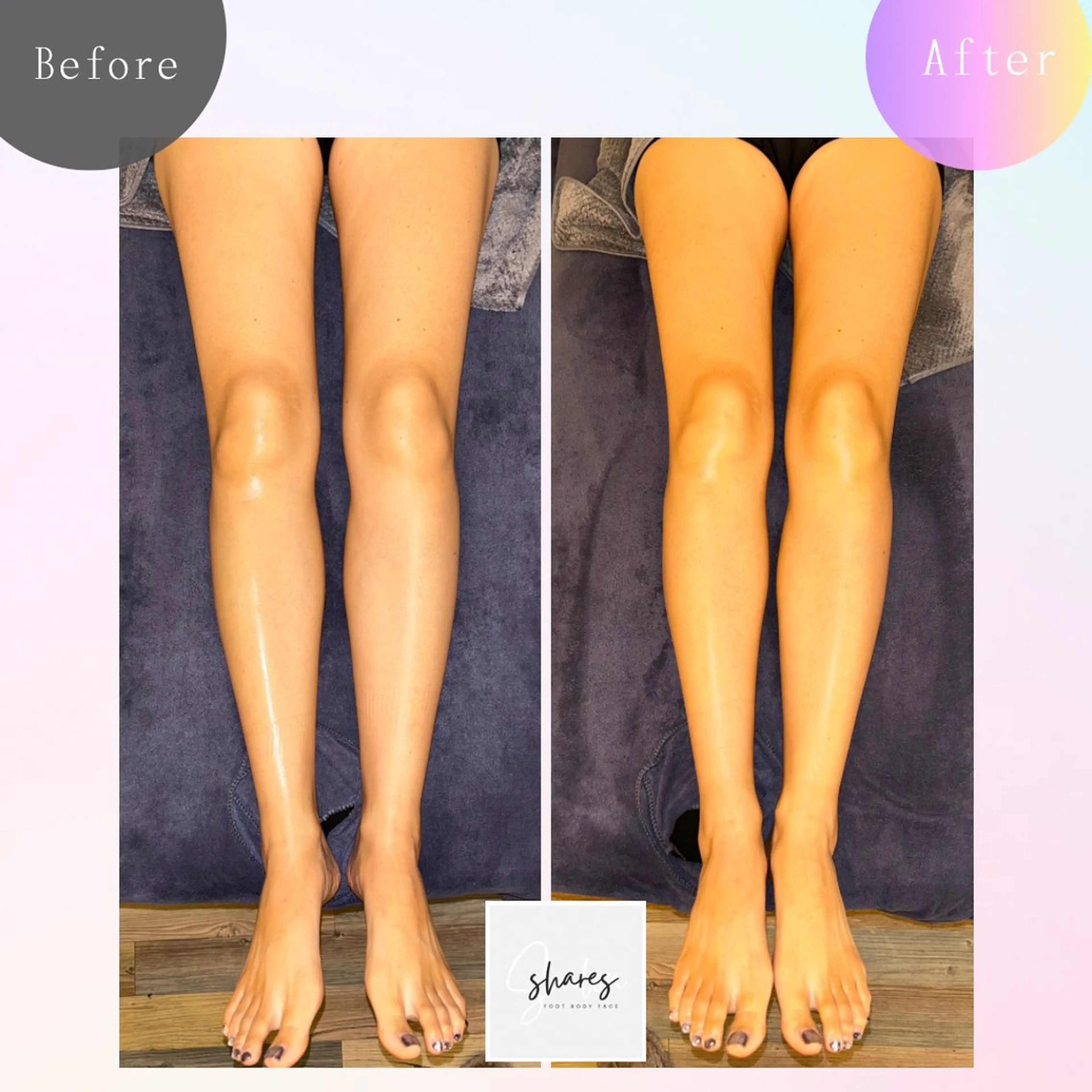 salon shares 辻堂店所属・SHARES AOIのエステ・リラクイメージ