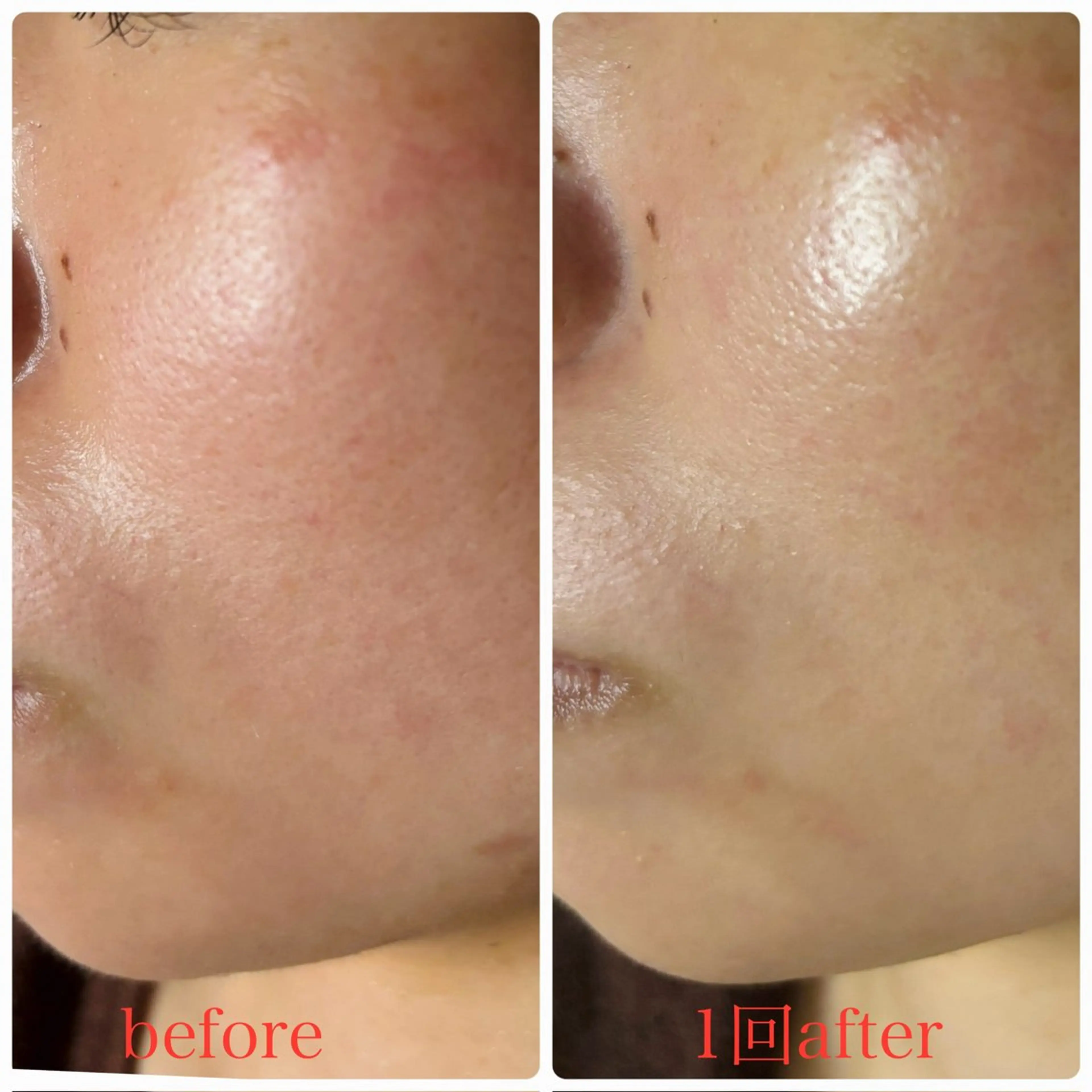 エステ 美ola ビオラのエステ・リラクイメージ