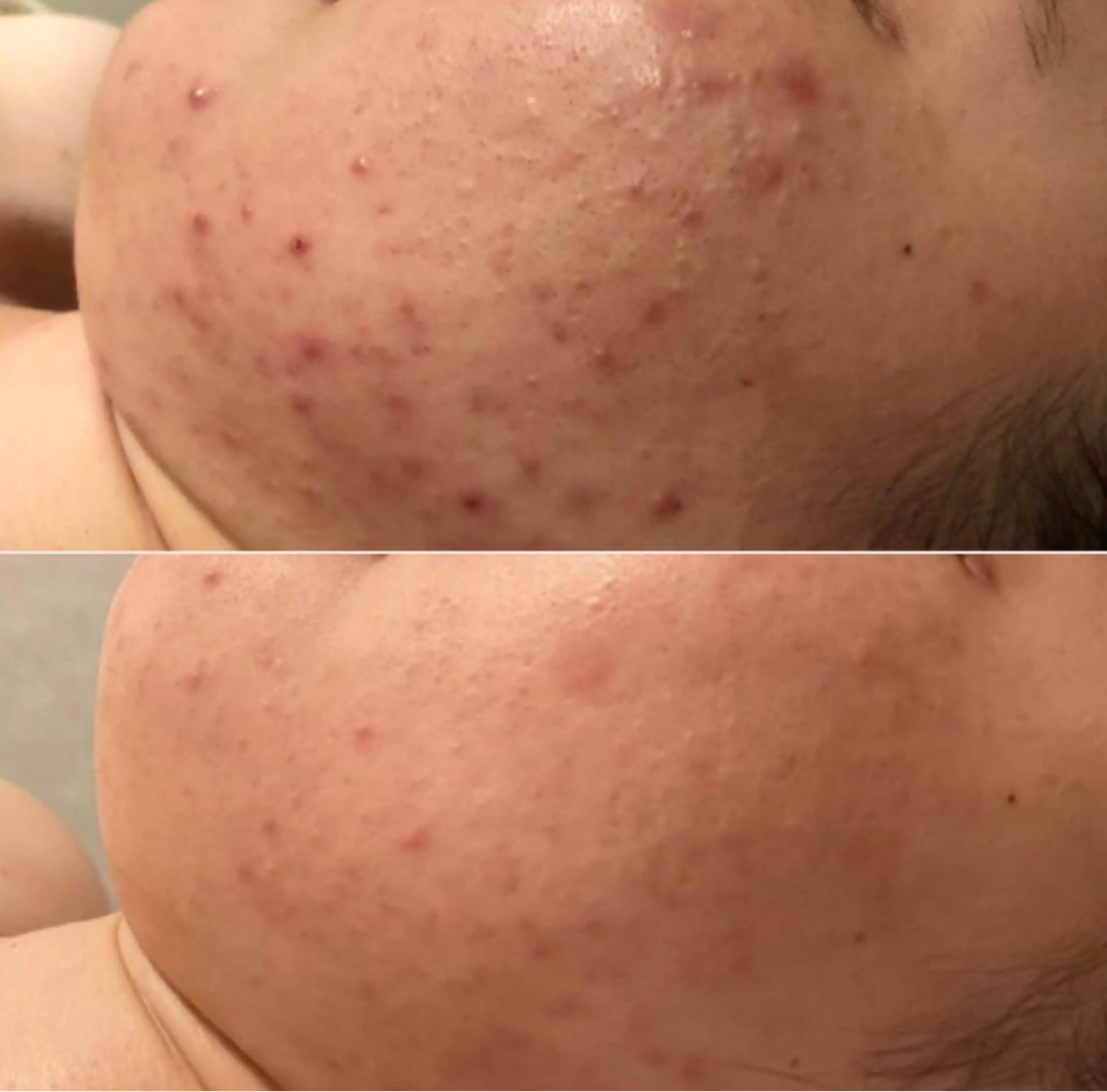 肌質改善/小顔/ ナスサロ/Yuiのエステ・リラクイメージ