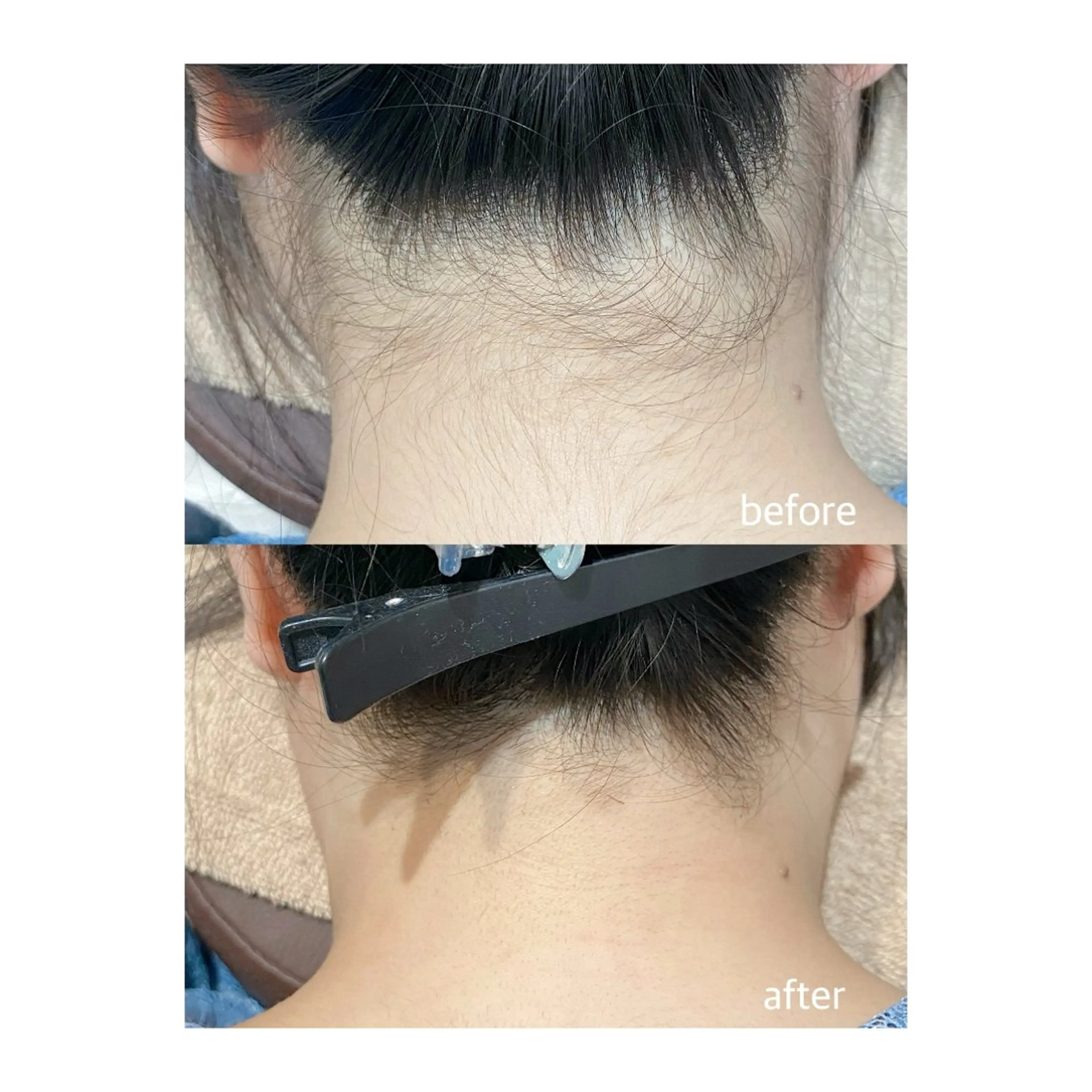 脱毛 M's Style NAIL BARのエステ・リラクイメージ