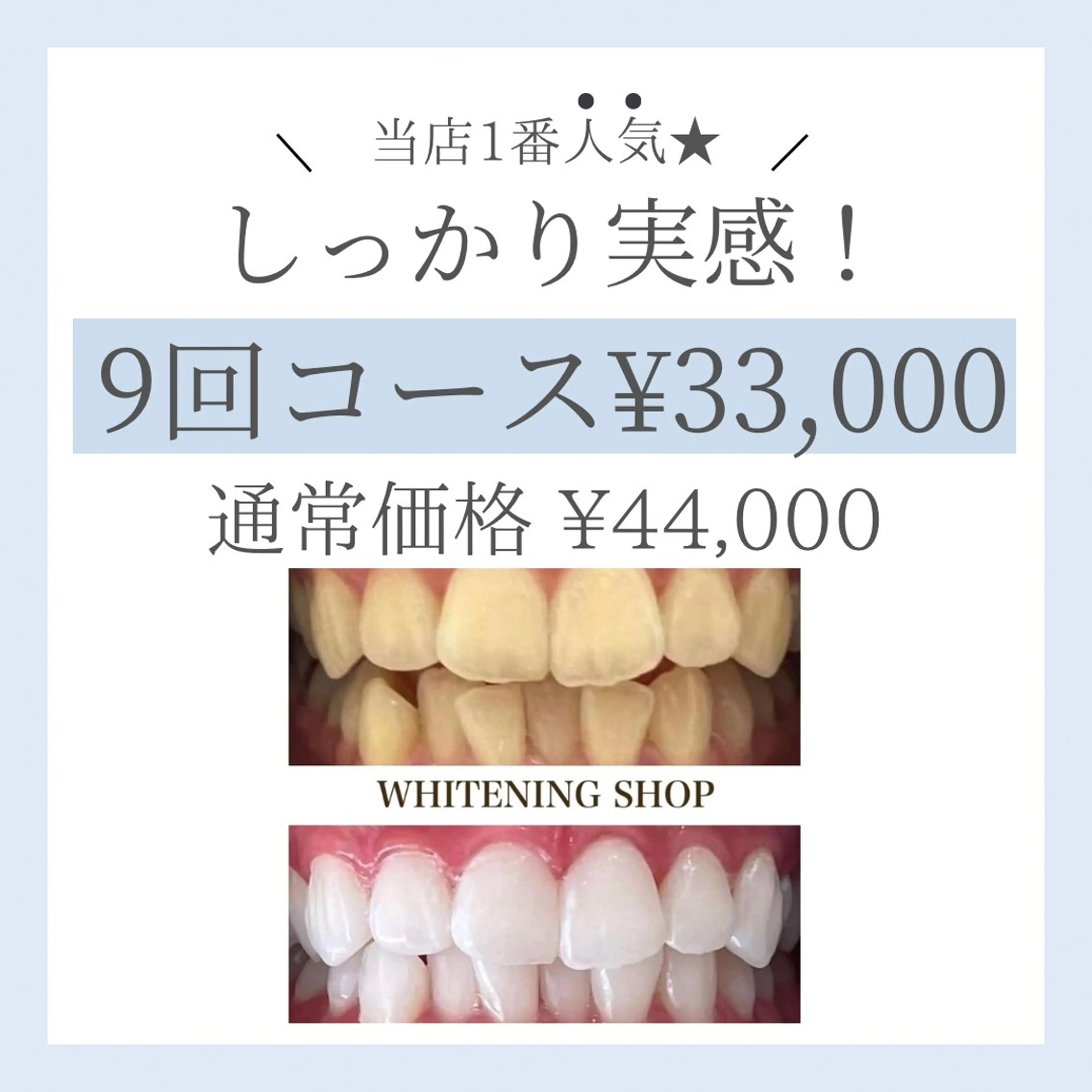 【人気No.1★フリーパス】有効期限無し!美白ホワイトニング40分×9回 (¥3666/回)¥44000→¥33,000の写真