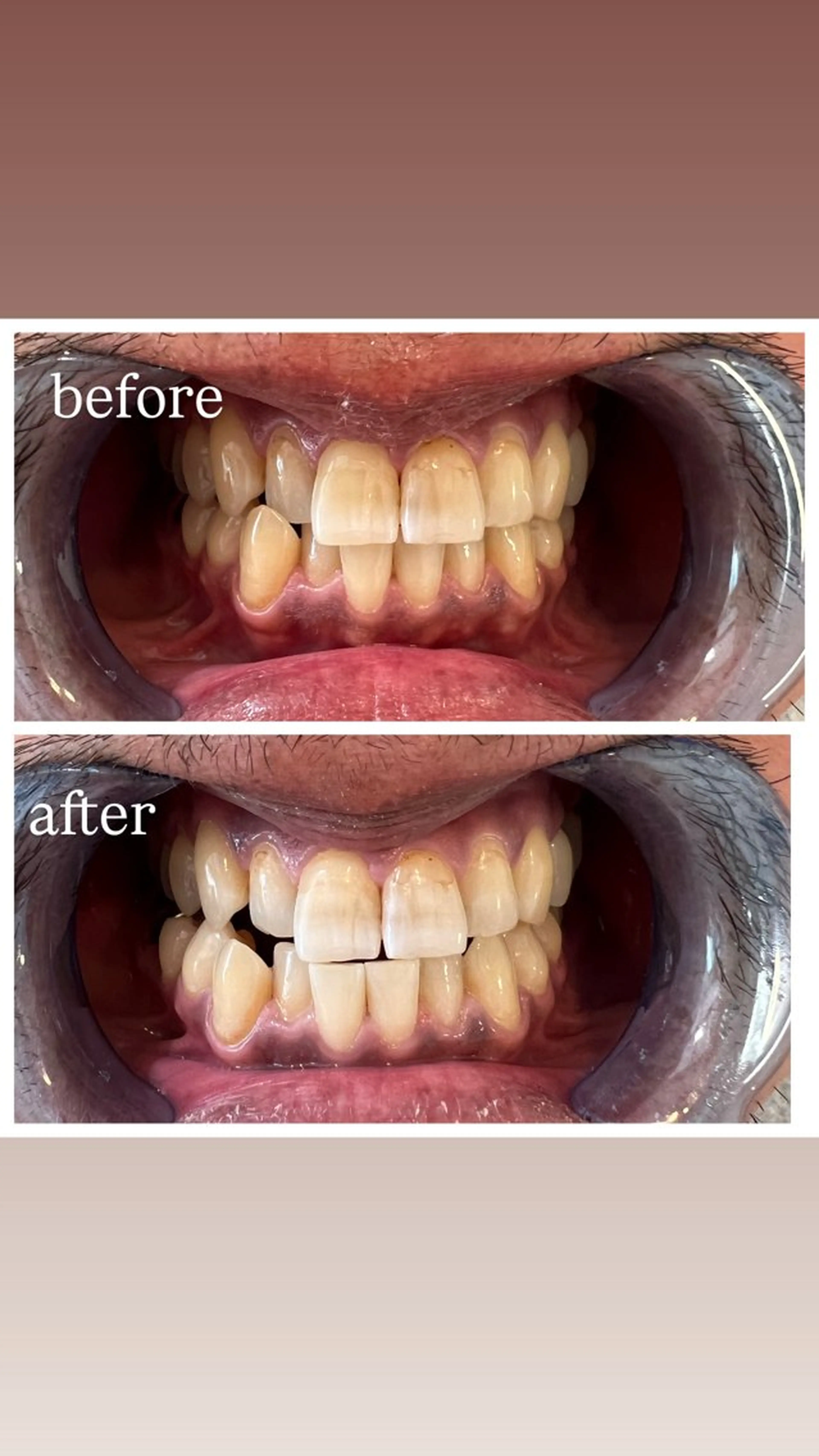 セルフホワイトニング Shineeのエステ・リラクイメージ