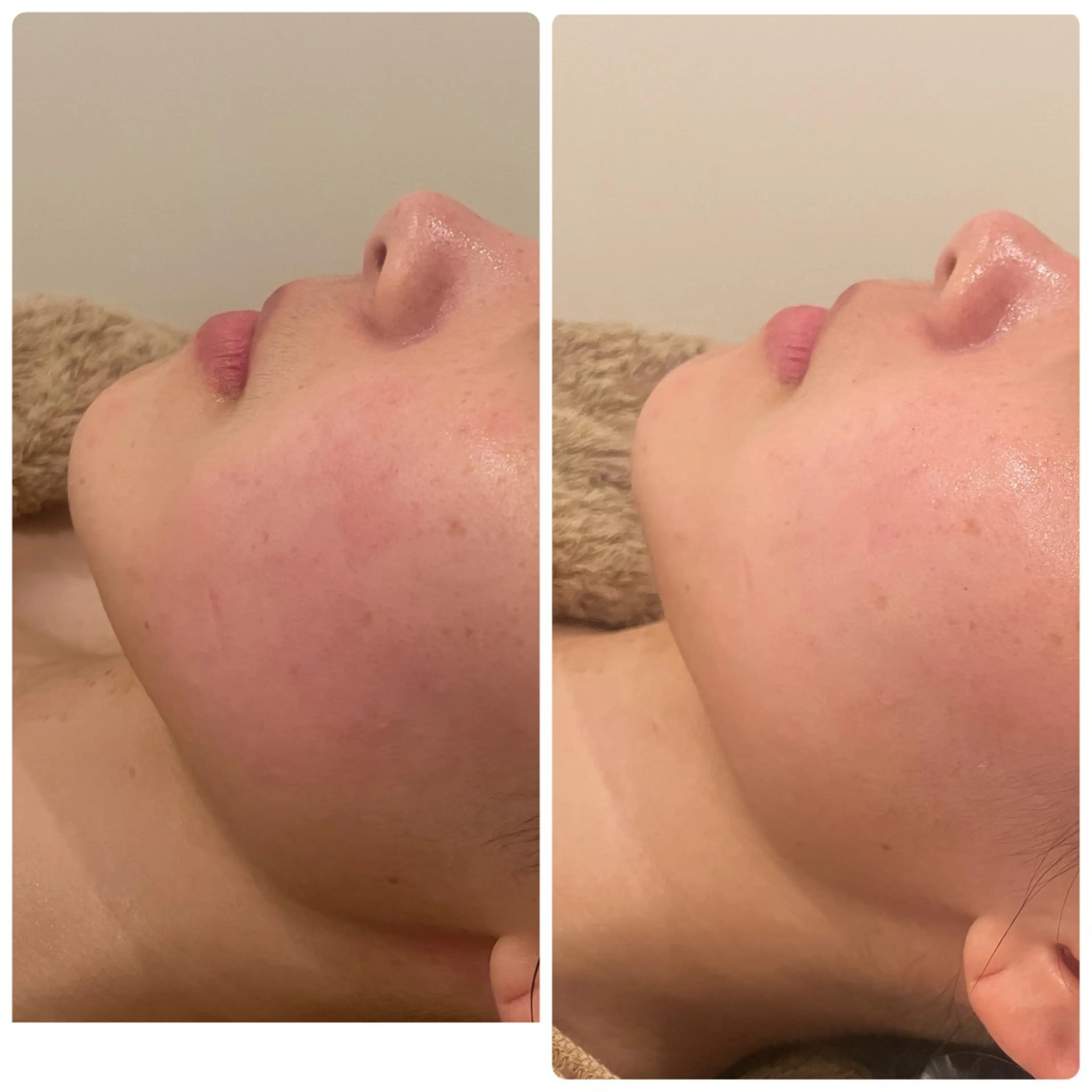 エステ リラク メナード片町 やまもと みくのエステ・リラクイメージ